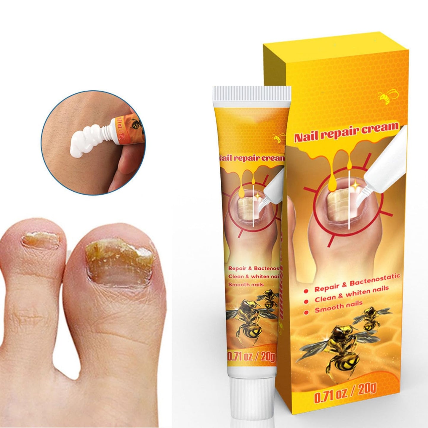 Bee Venom Nail Repair Cream, Whitening and Smoothing Treatment, Repairs Damaged Nails, Strengthens Nails, Promotes Nail Health, Nourishes and Moisturizes