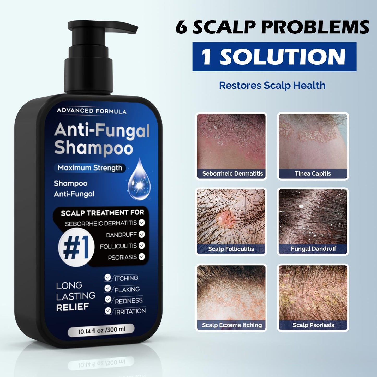Antifungal Shampoo for Seborrheic Dermatitis, Folliculitis & Scalp Psoriasis, Anti-Dandruff Shampoo for Men & Women, Relieves Scalp Itching, Dryness, Sulfate & Paraben-Free, 10.1 Fl Oz