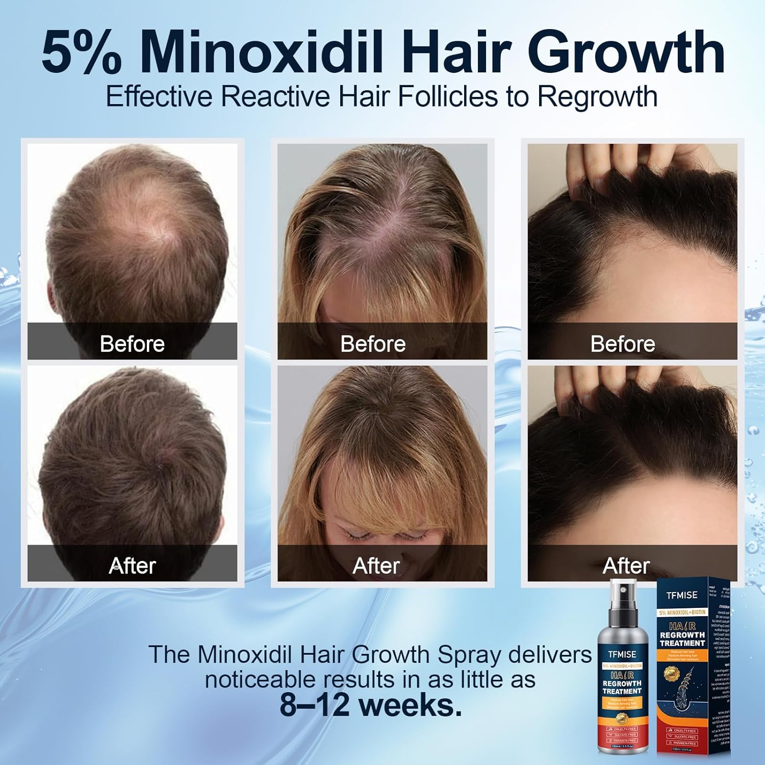 5% Minoxidil Spray for Men & Women - Extra Strength Hair Growth Solution with Biotin, 3.38 Fl. Oz