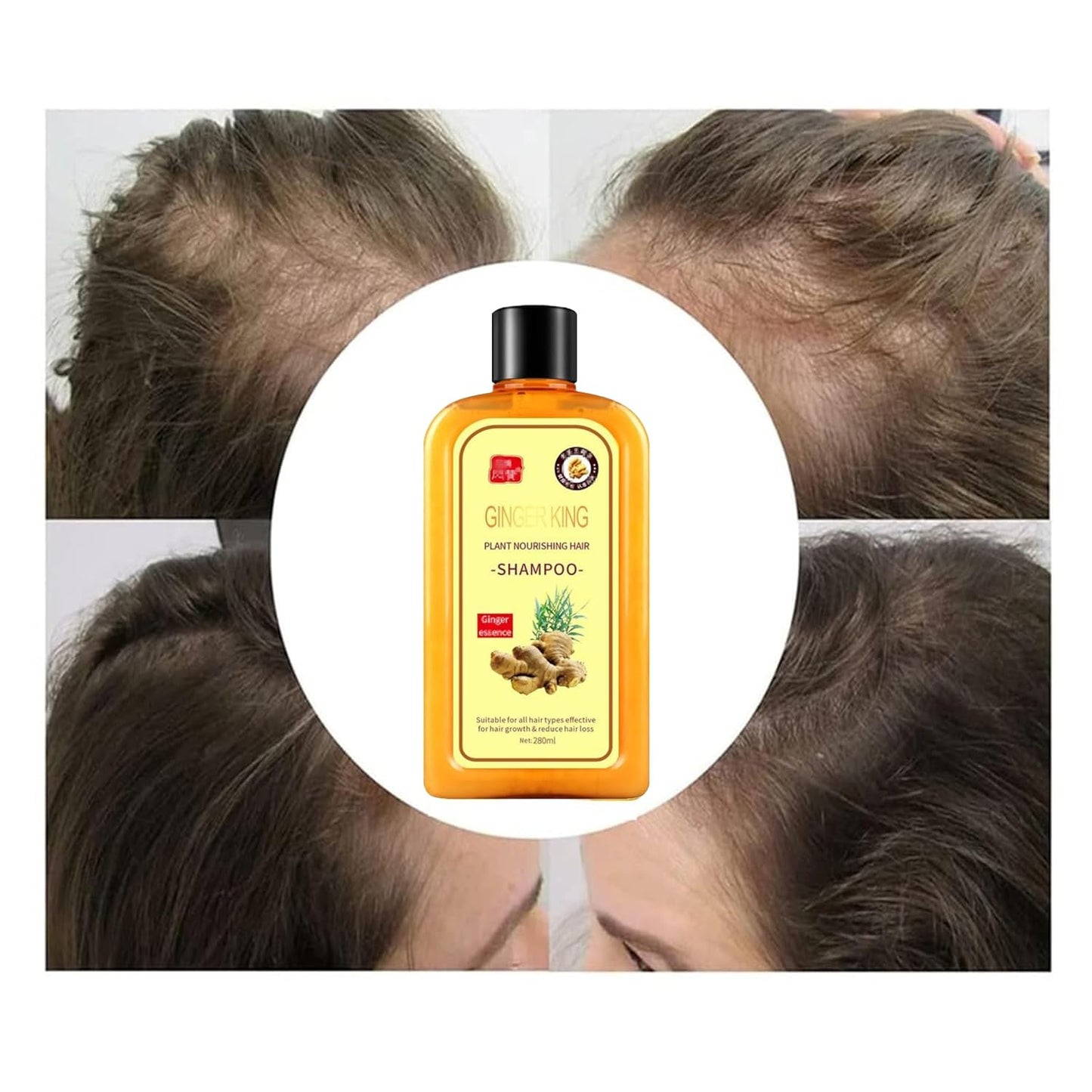Ginaday Ginger Hair Regrowth Shampoo - Anti-Hair Loss & Fall Treatment (500ML)