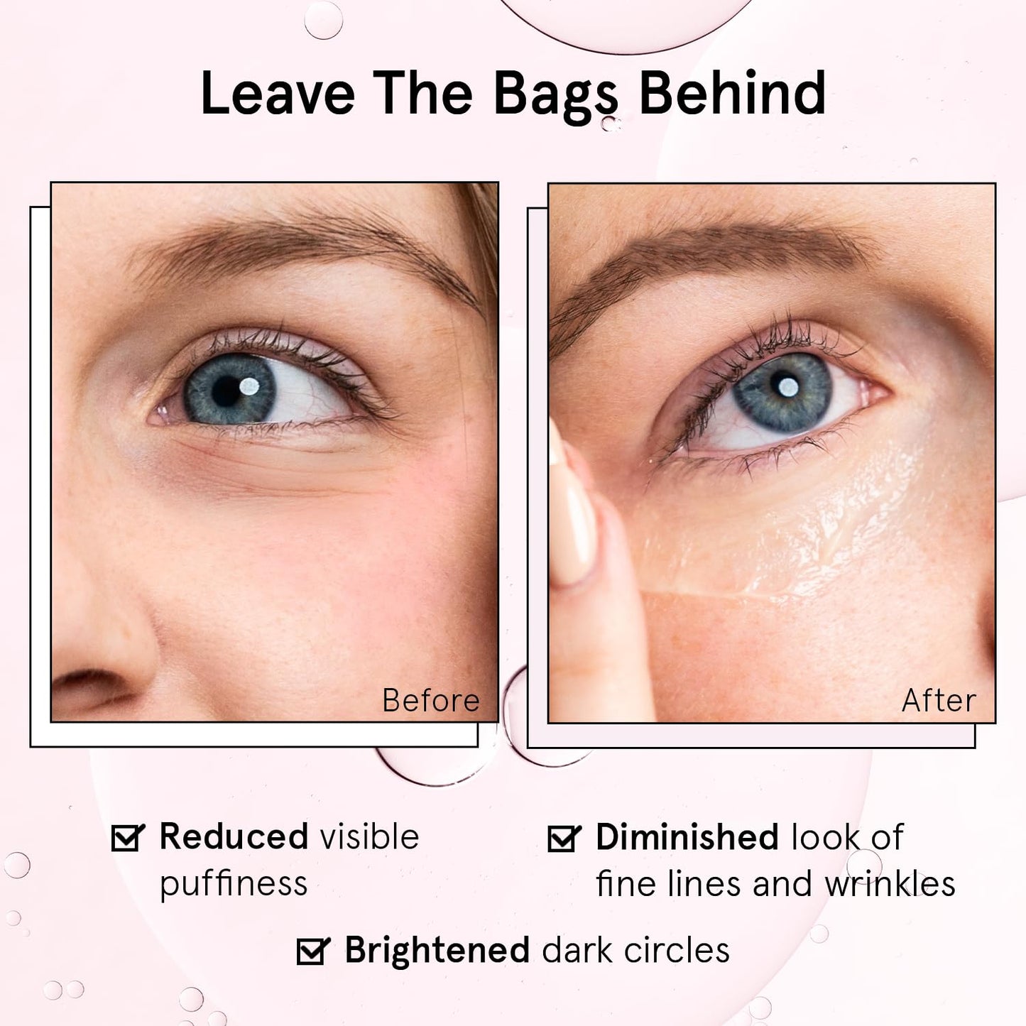 grace & stella Under Eye Brightener Roller - Airplane Travel Essentials - Travel Size Toiletries - Retinol & Caffeine Eye Serum for Puffiness, Dark Circles, Wrinkles - Vegan Skincare (15ml / 0.51floz)