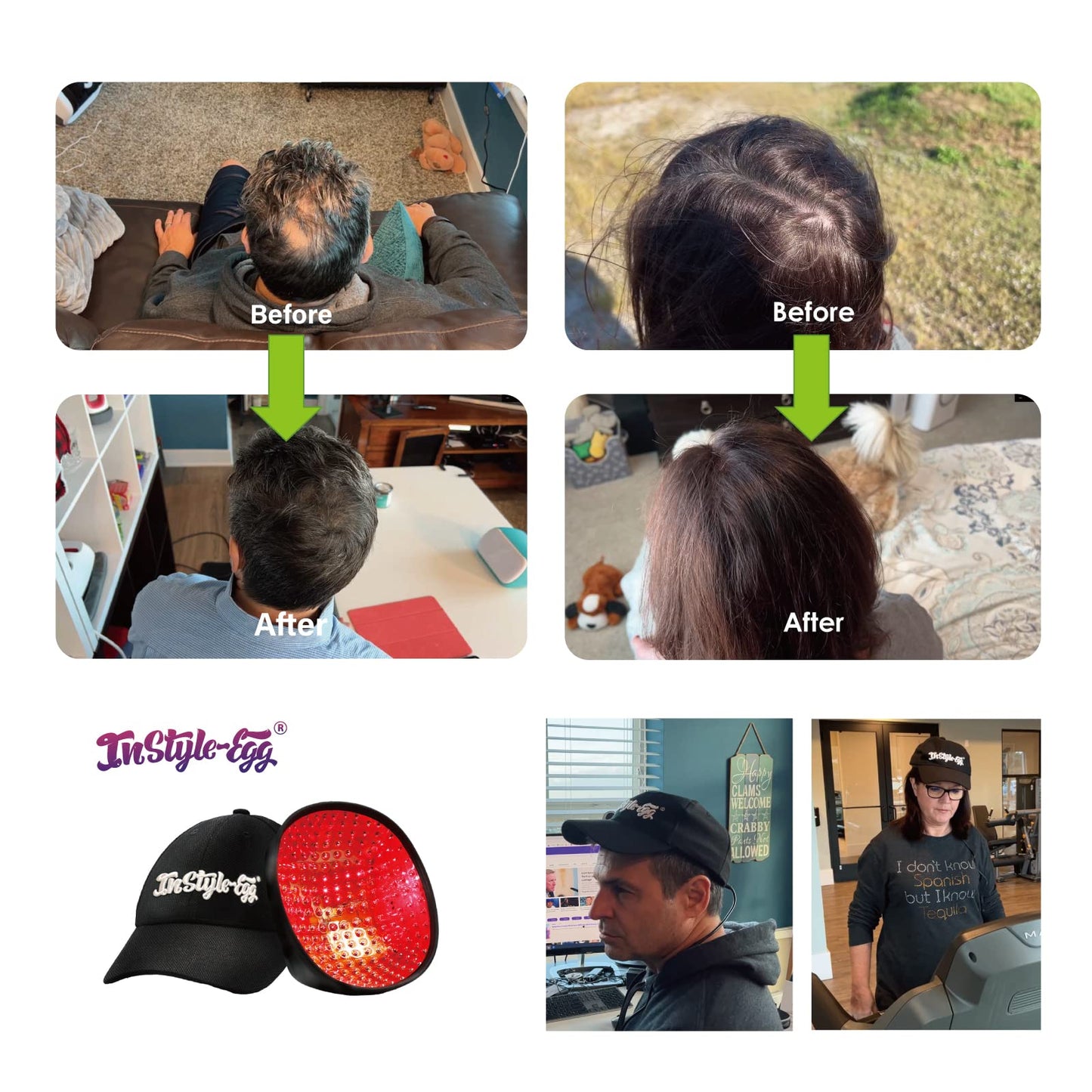 272 Laser Cap for Hair Growth, Hair Regrowth System for Men/Women, Scalp Treatment to Stop Hair Loss and Regrows Thinning Hair