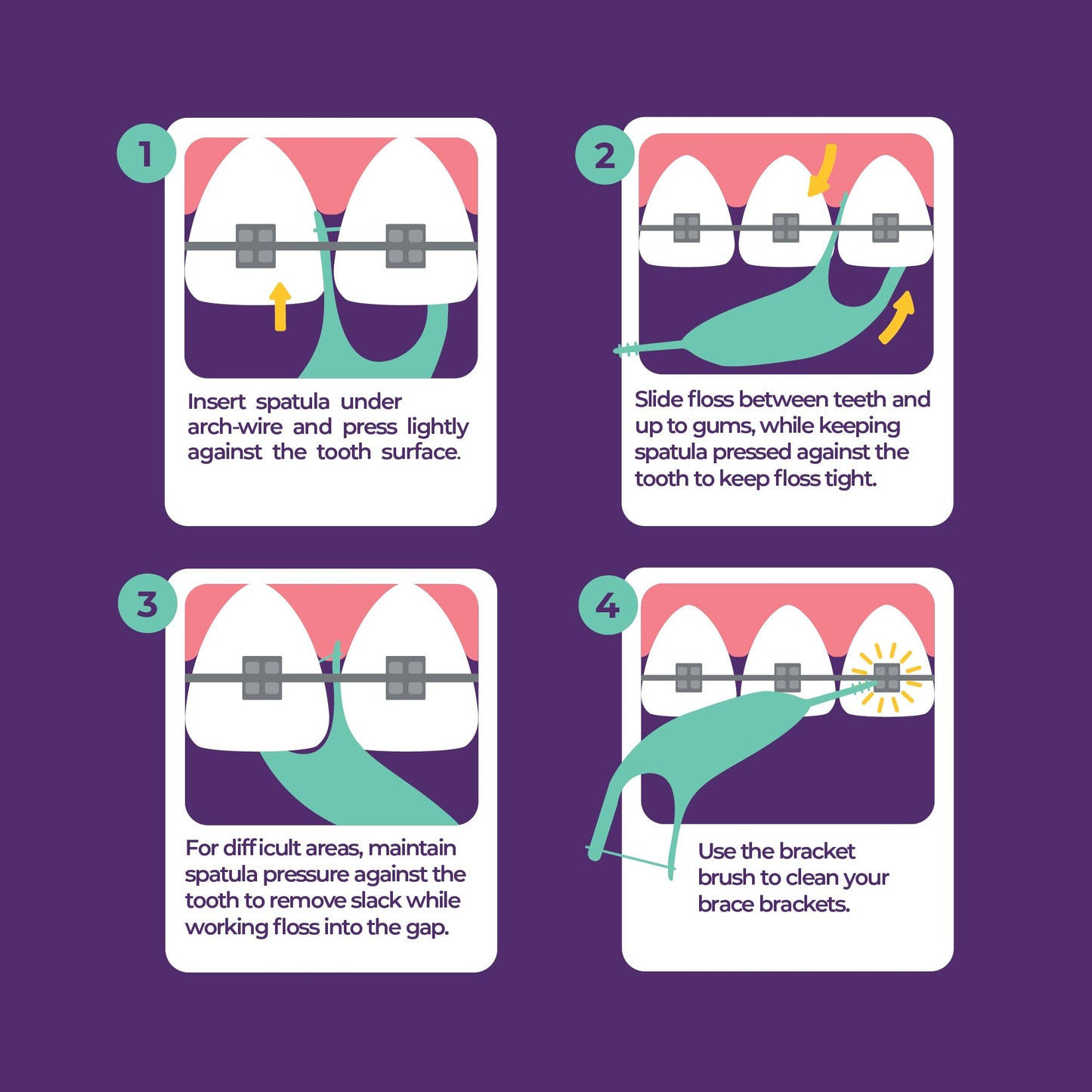 Platypus Orthodontic Flossers for Braces, 30 Count (Pack of 2), Ortho Picks for Adults & Kids, Fits Under Arch Wire, Non-Damaging, Encourage Flossing Habits