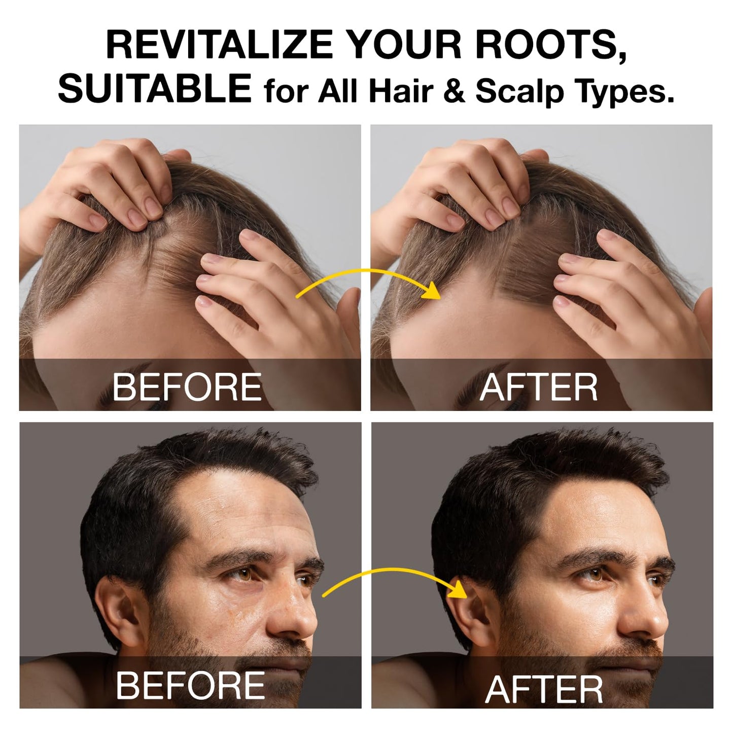 Root Activator Shampoo for Men: Hair Growth Shampoo for Hair Loss and Thinning Hair - 9.29 fl oz / 275 mL