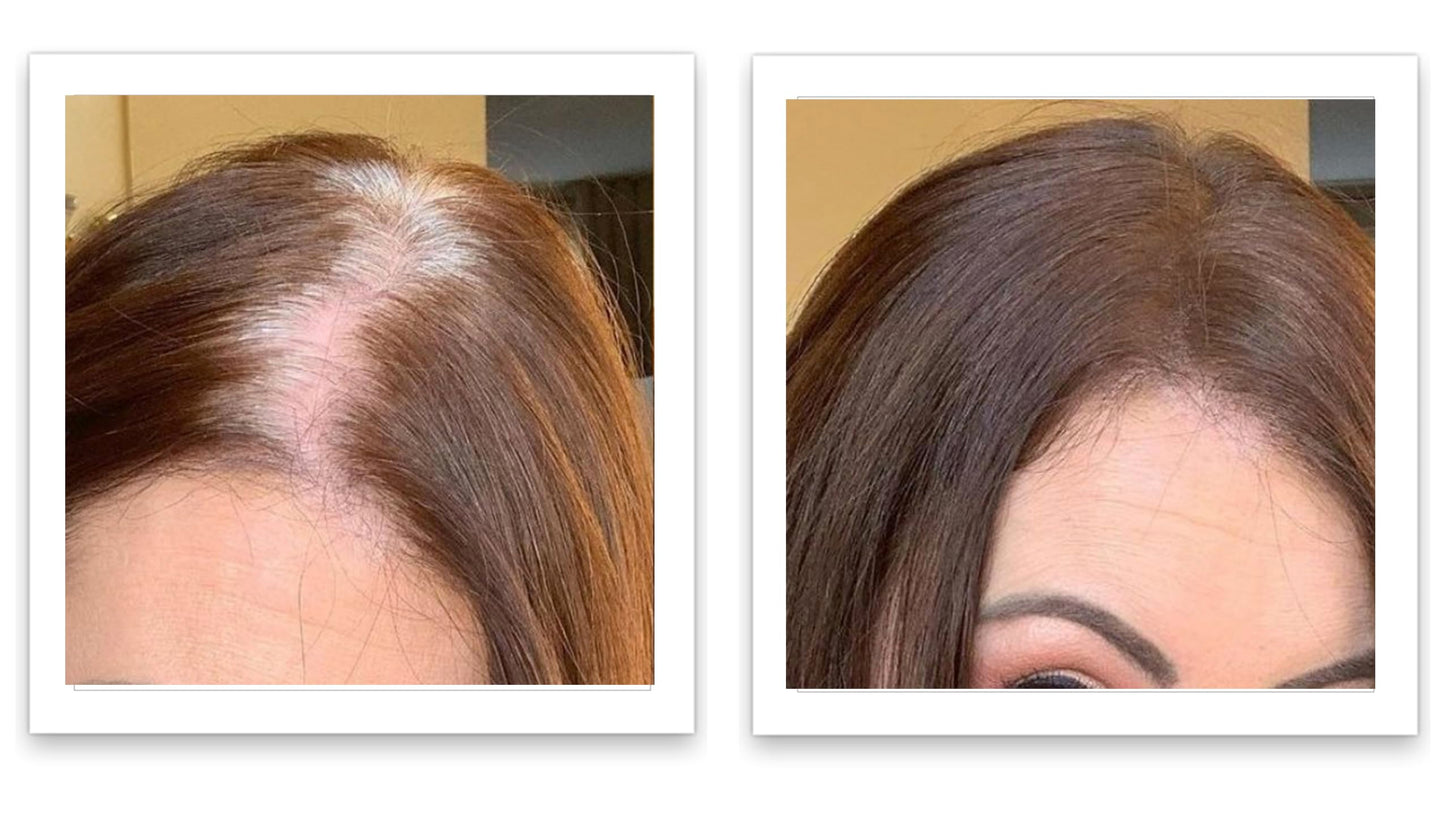 Caboki 10X Volumizing Hair Powder for Thinning Hair: Root Touch Up, Fill in Hairline & Edges, Cover Bald Spots and Gray For Men and Women. TALC-Free,Dark Brown