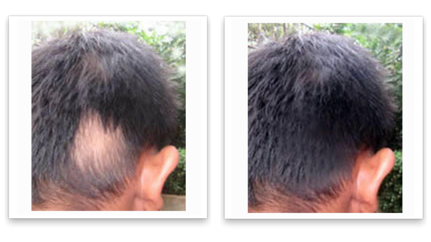 Caboki 10X Volumizing Hair Powder for Thinning Hair: Root Touch Up for Men and Women, Fill in Hairline & Edges, Cover Bald Spots. TALC-Free, Dark Gray