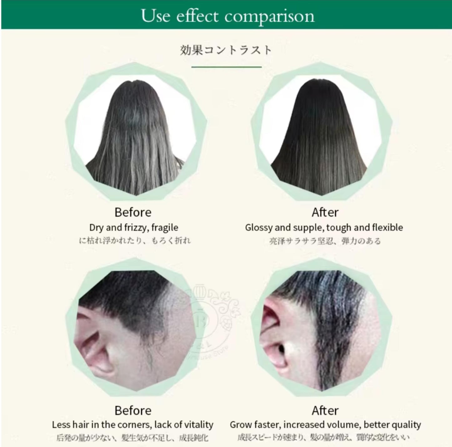 Hair Growth Tonic, Anti Hair Loss Tonic 240 ml (8.1 fl oz)
