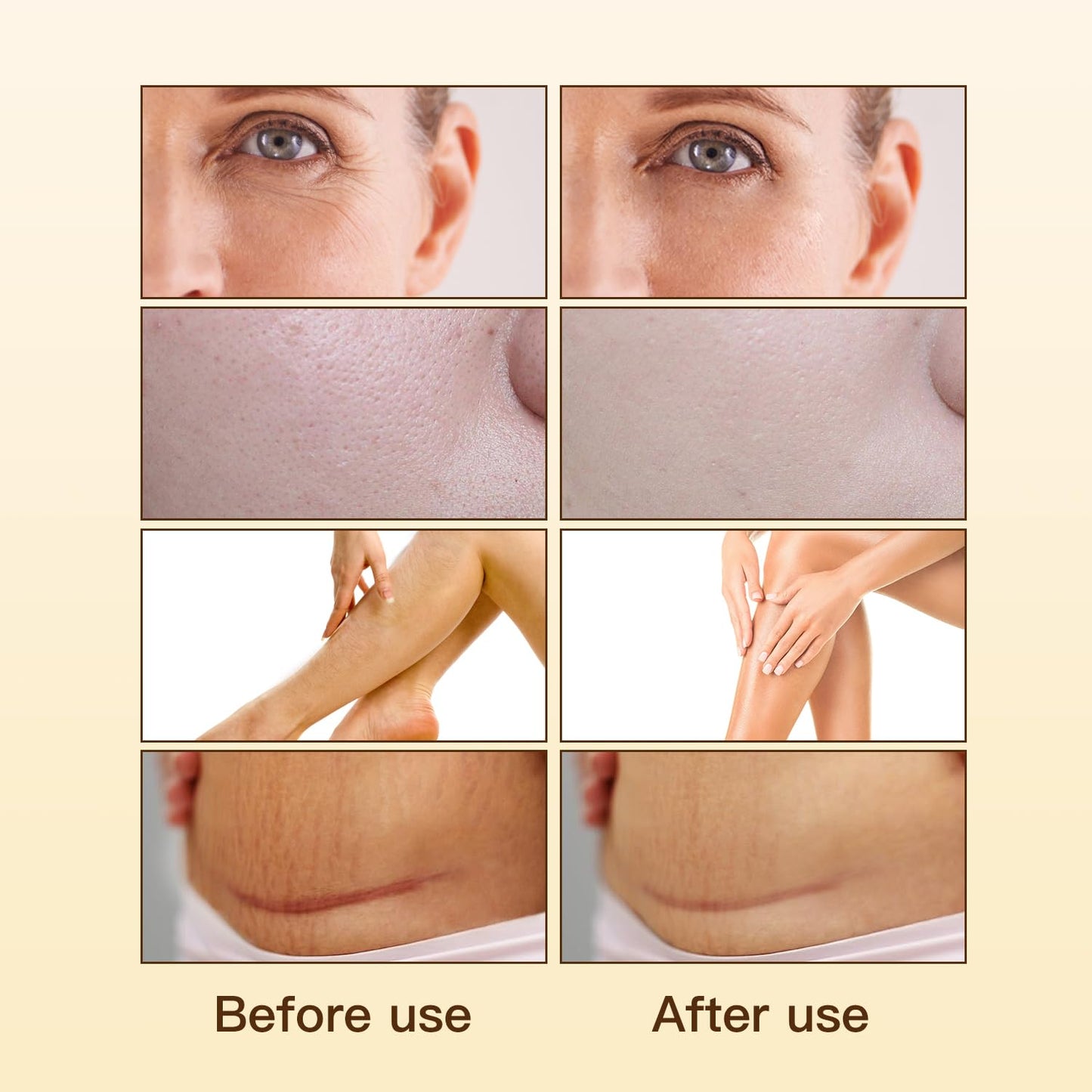Vitamin E Oil 80,000 IU with Bakuchiol for Wrinkles & Scars - 30ml Natural Skin Moisturizer
