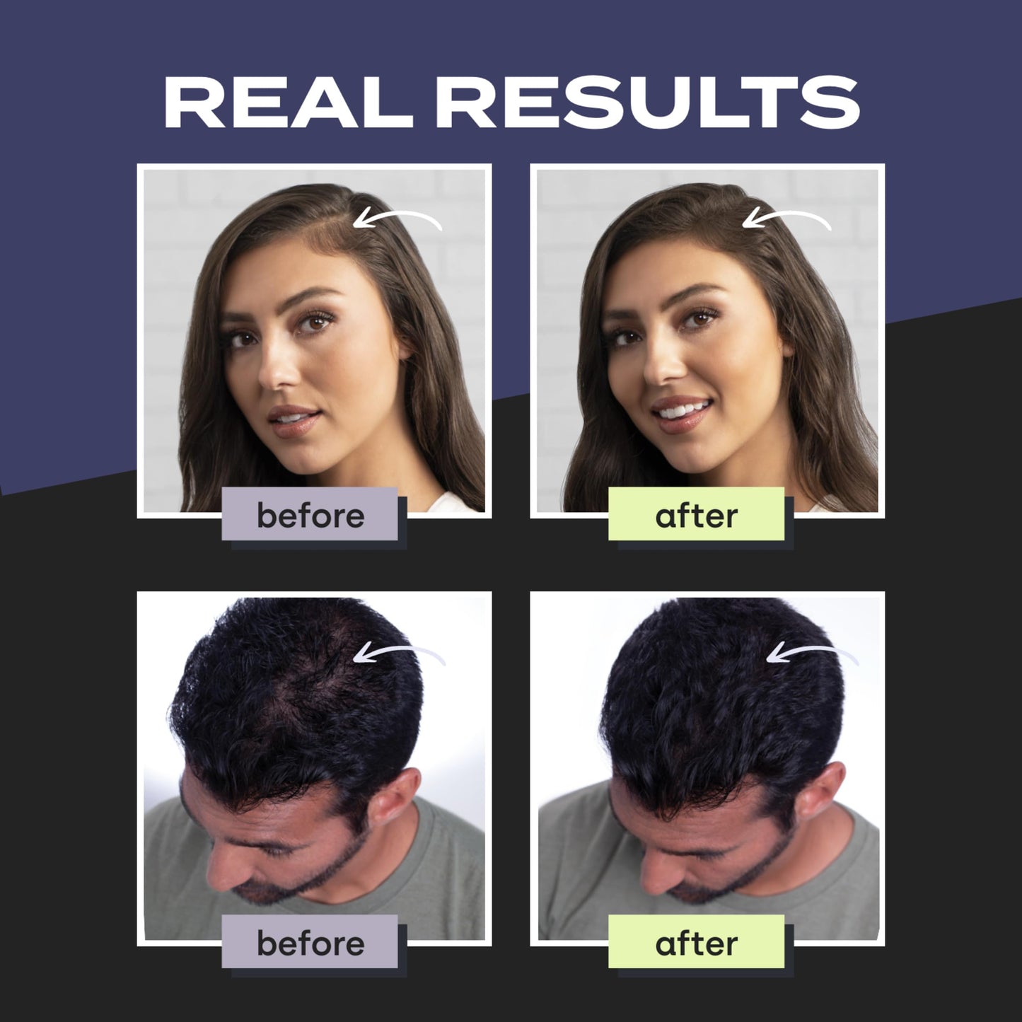 Toppik Hair Building Fibers, Medium Brown, 12g Fill In Fine or Thinning Hair, Instantly Thicker, Fuller Looking, 9 Shades for Men & Women, Keratin Protein Formula