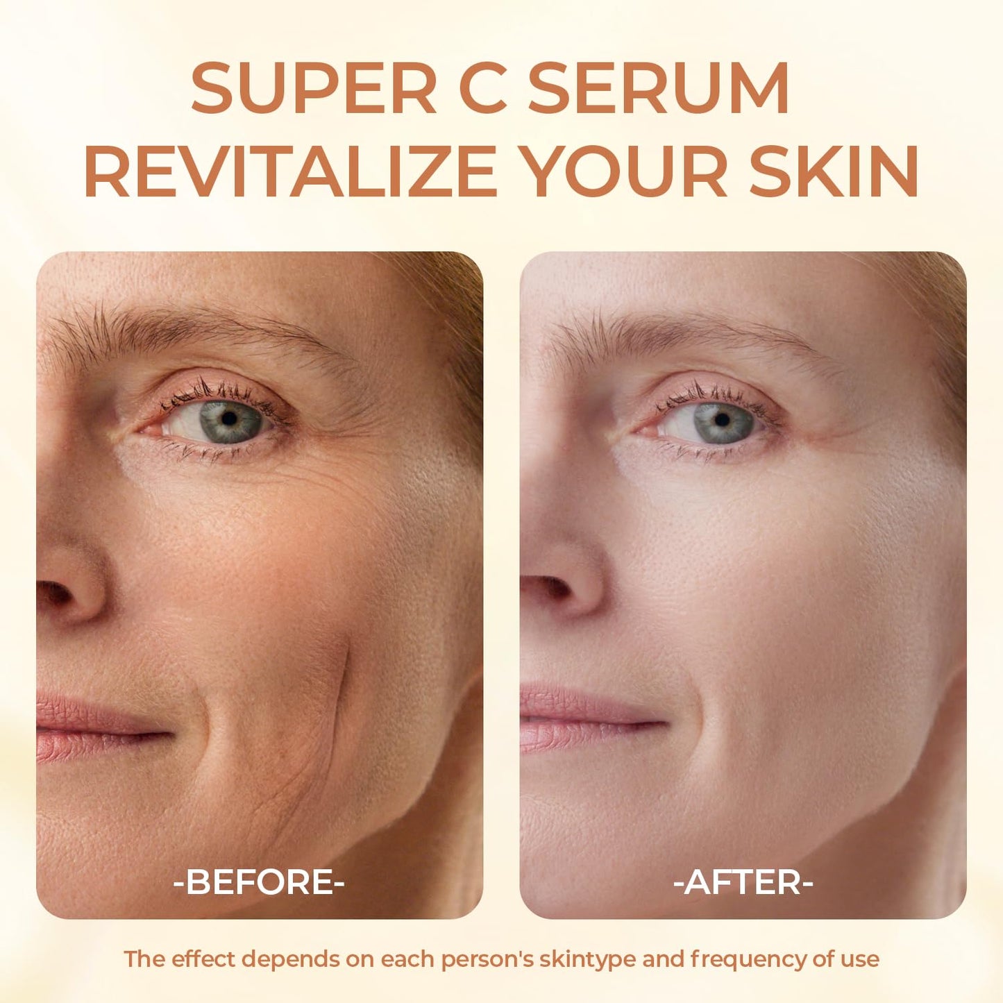 Vitamin C Serum for Mature Skin - Hydrating Anti-Aging Facial Care for Women 70+ - Firming & Smoothing Formula, 1.69 fl oz