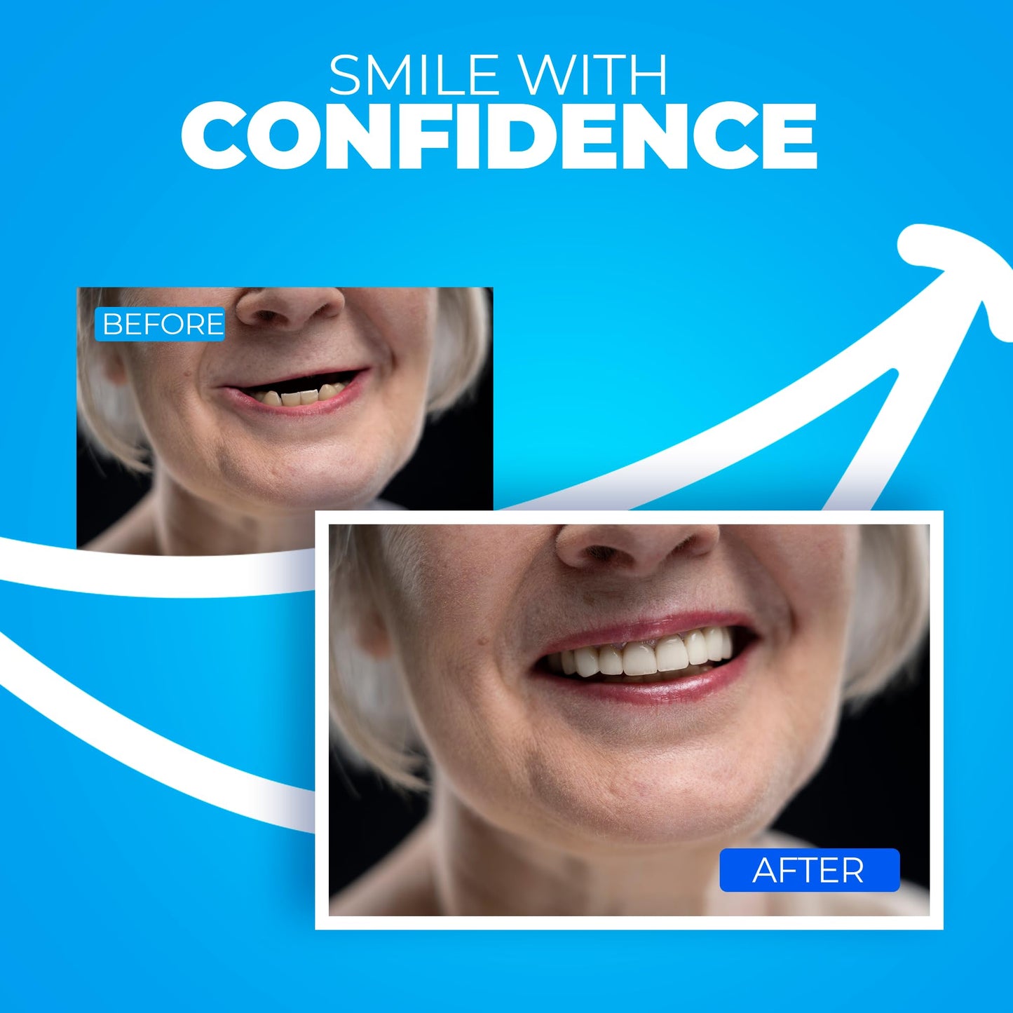 Jesse Dent - DIY Dentures, Customizable Kit with 12 Pieces, Simple to Use. Dentures Upper and Lower, Home Denture Solution for an Ideal Smile, Women and Men