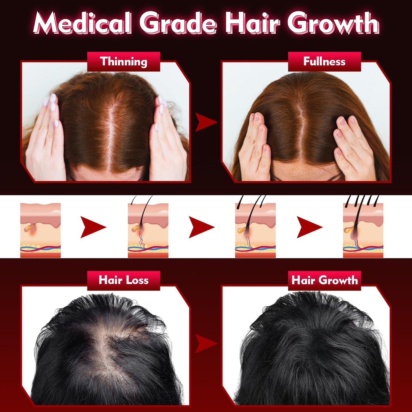 Hair Growth Device - FDA Cleared - UUPAS Professional Laser Diodes Red Light Therapy Hair Growth Cap System for Hair Regrowth, Alopecia - Hair Growth Treatments Products for Men Women