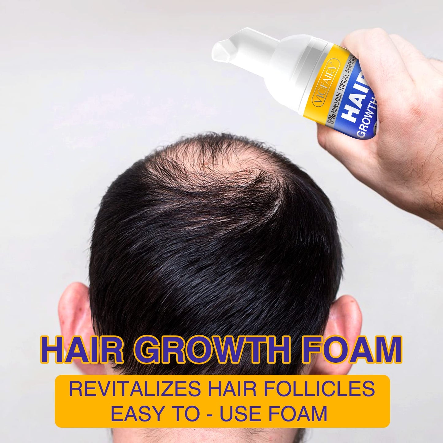 5% Minoxidil Foam for Hair Growth and Thickening - Biotin & Minoxidil Treatment to Stop Thinning & Hair Loss for Men & Women, 2oz