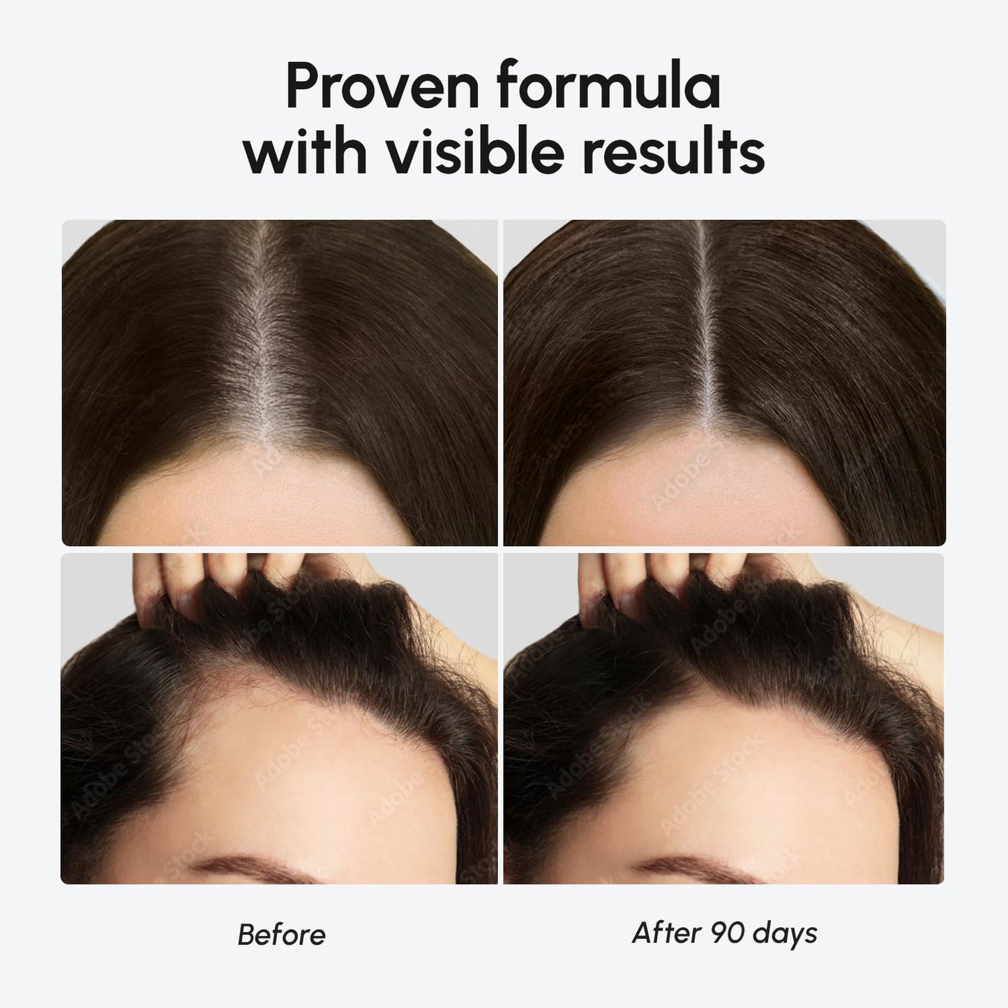 MAREE Hair Growth Serum - Scalp Revival with 100 Peptides for Lightweight Botanical Care