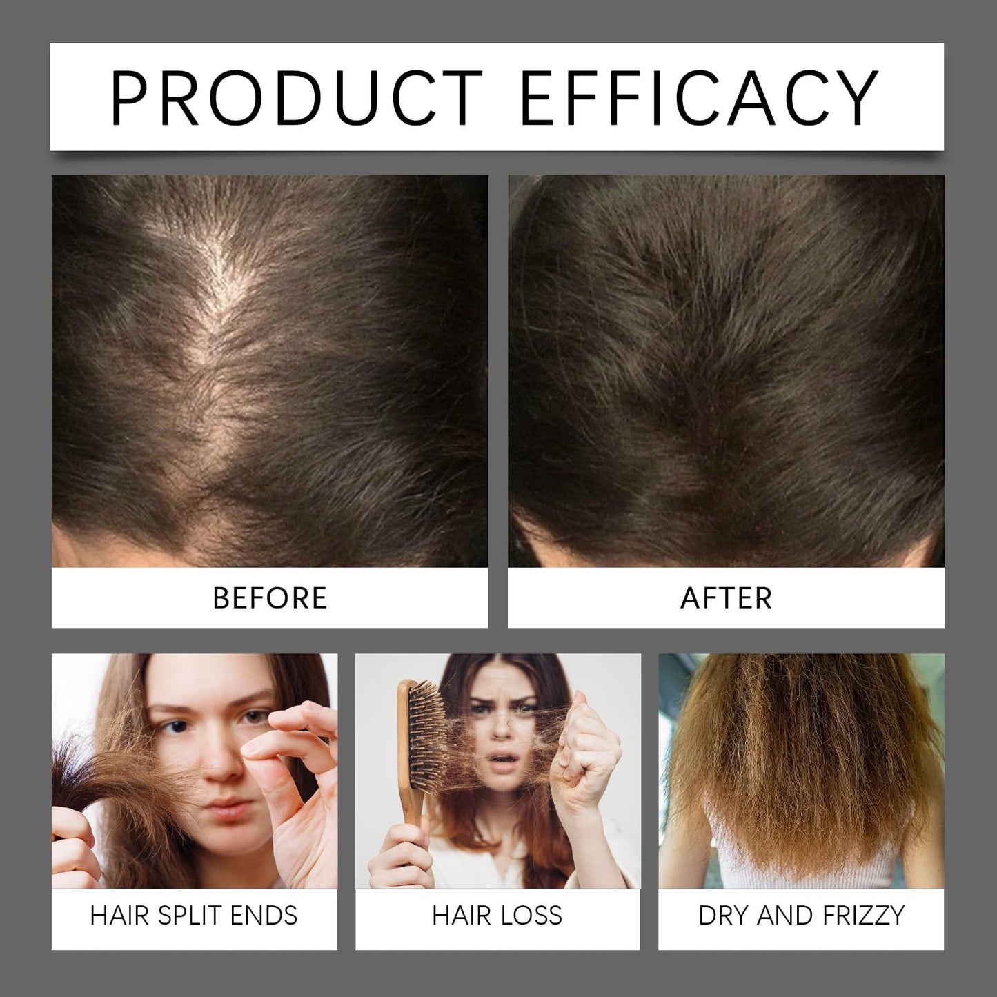 Deoxyribose Sugar Gel Hair Growth, 60ml Deoxyriboes Hair Growth Serum Suitable for All Hair Types (2bottle)
