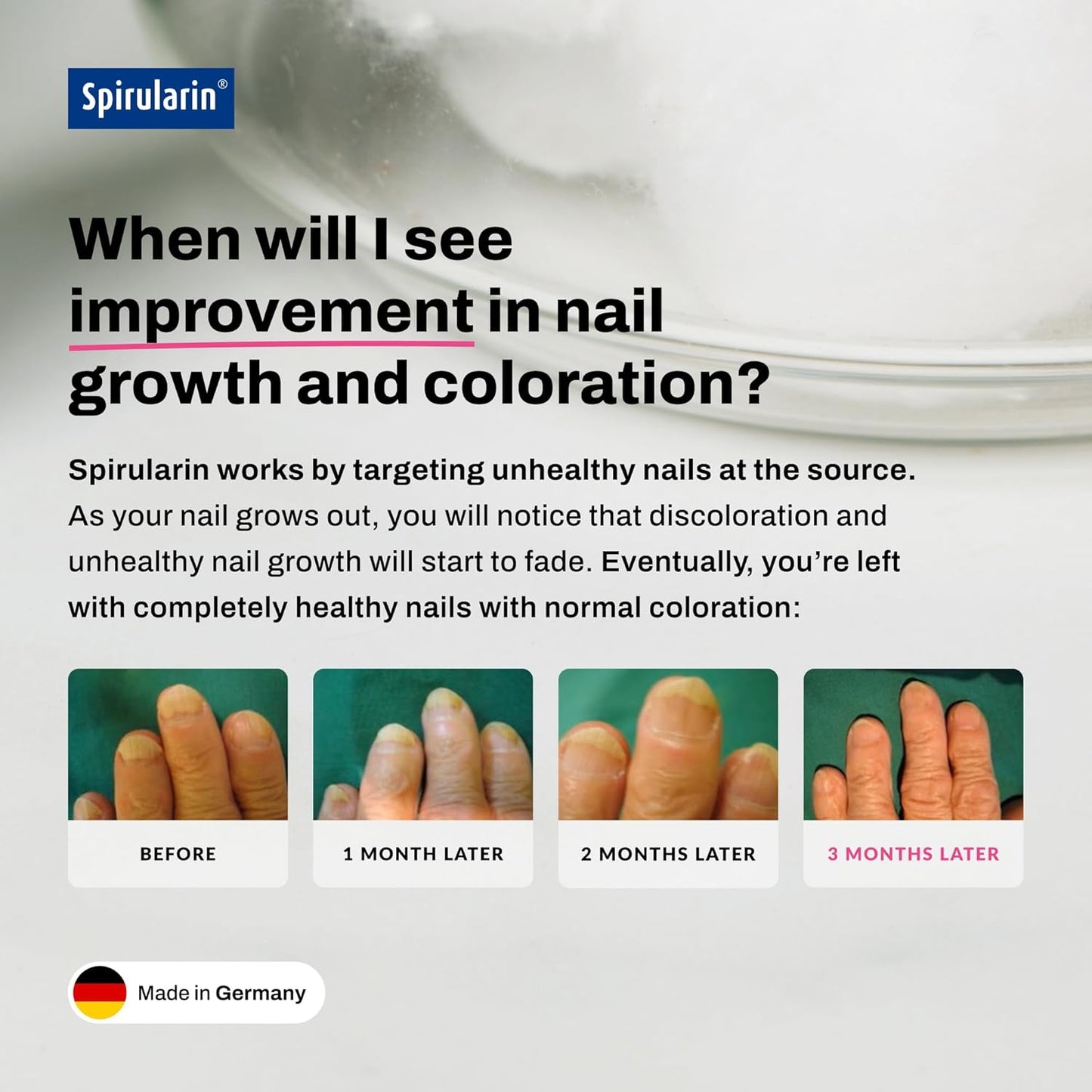 Nail Serum for Discolored Nails - Natural Remedy for Healthy Fingernails & Toenails | 0.34 Fl Oz Made in Germany