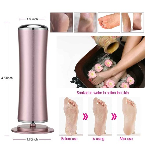 SRGARH Electric Callus Remover for feet, Adjustable Speed Foot File, with 60pcs Sandpaper Discs - for Cracked Heels - Working Women's Summer Pedicure Tool (Pink)
