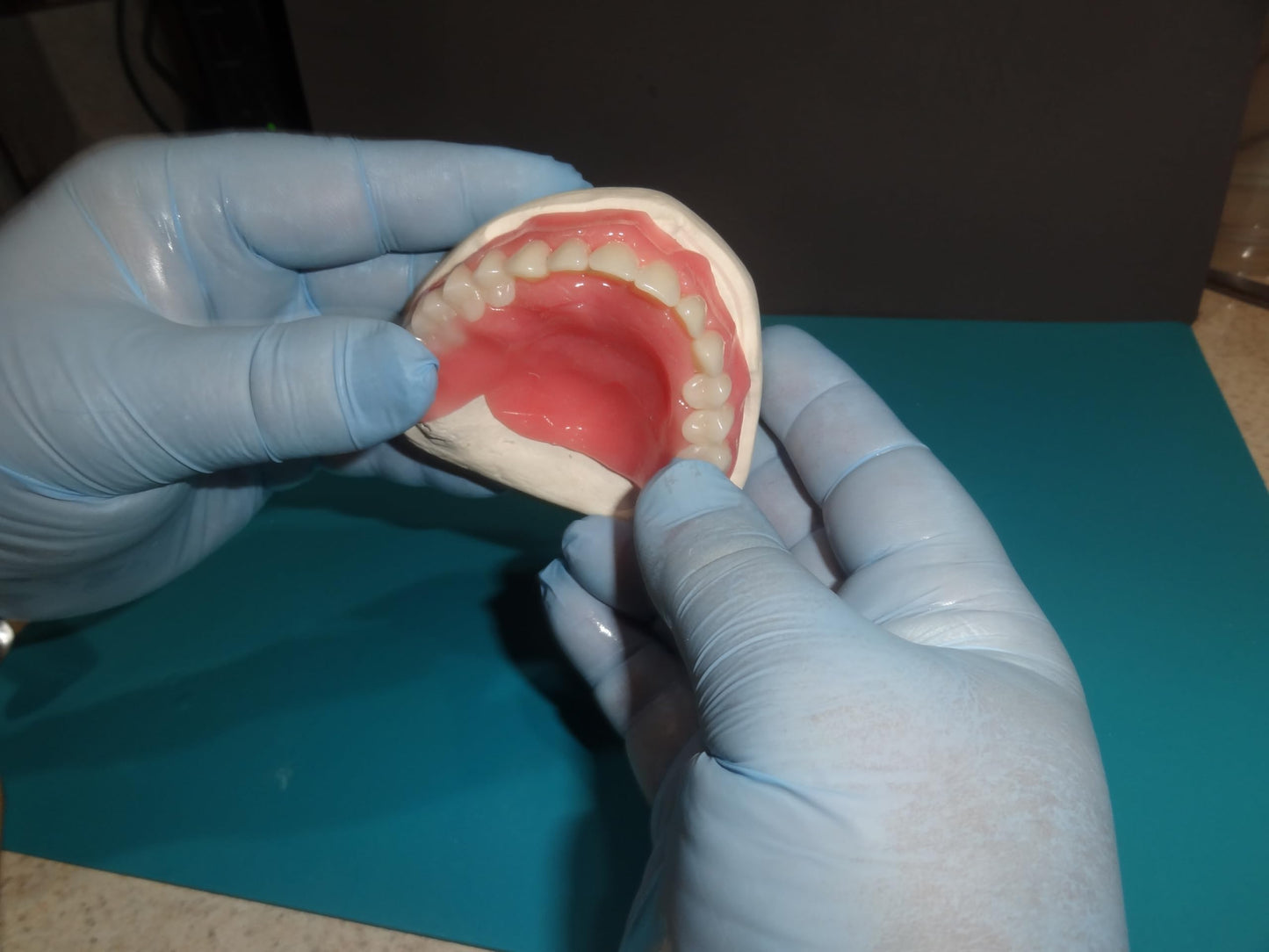 Jesse Dent - DIY Dentures, Customizable Kit with 12 Pieces, Simple to Use. Dentures Upper and Lower, Home Denture Solution for an Ideal Smile, Women and Men