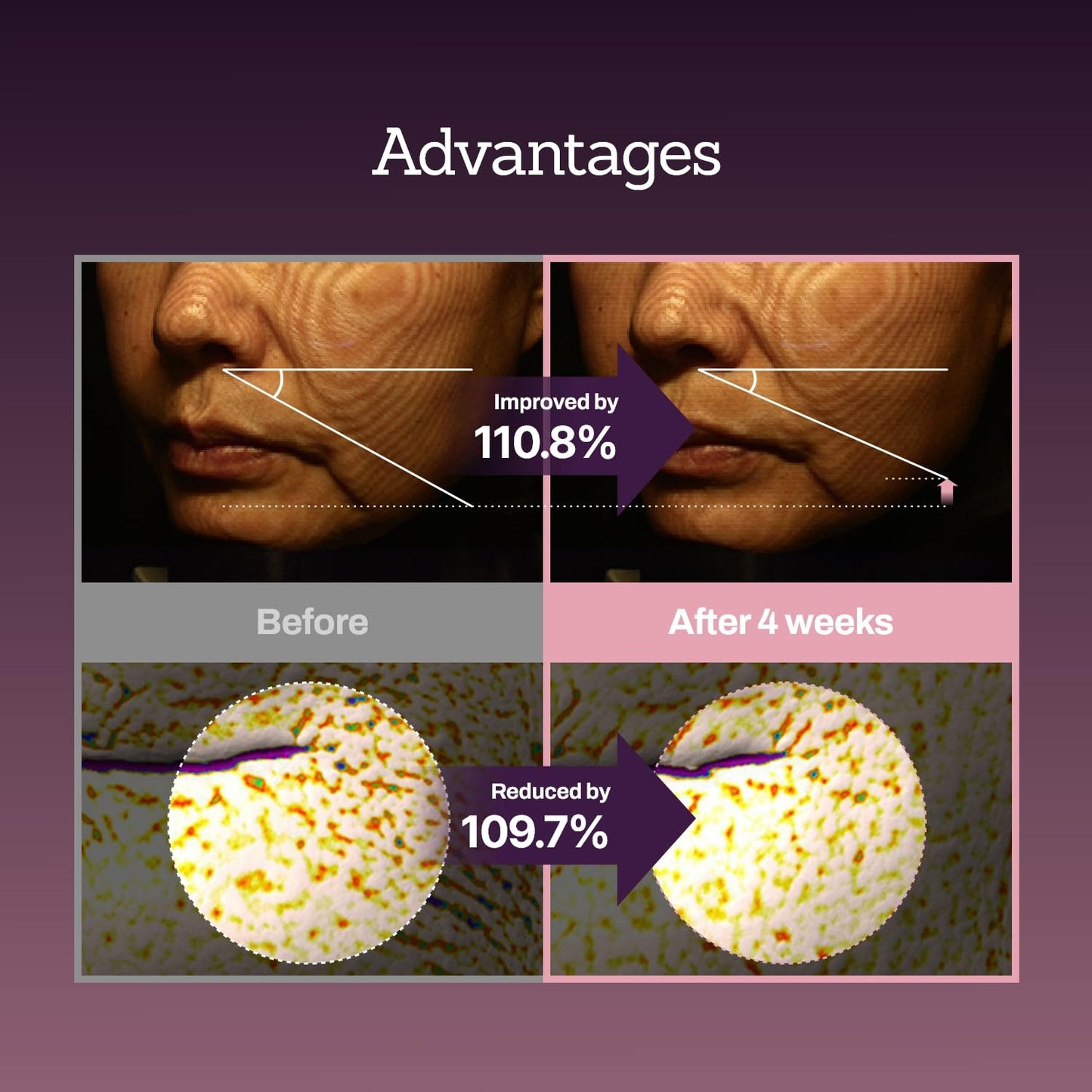 Collagen Peptide Serum for Firm, Youthful Skin - Reduces Deep Wrinkles & Boosts Elasticity, 1.01 fl. oz - Korean Skincare