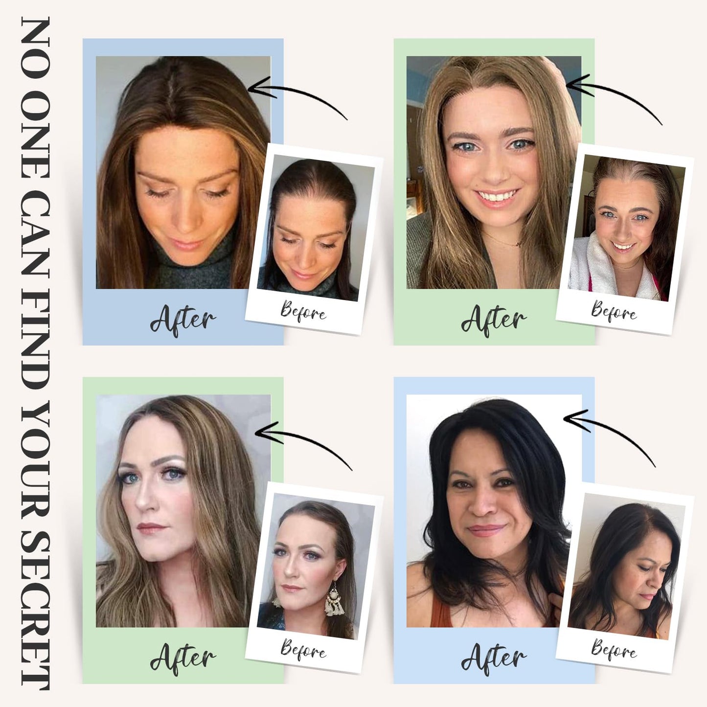 SEA SINGING Hair Toppers for Women Real Human Hair Upgrade Swiss Base Hand-Tied Invisible 10 Inch Toppers Hair Pieces for Women(2#)