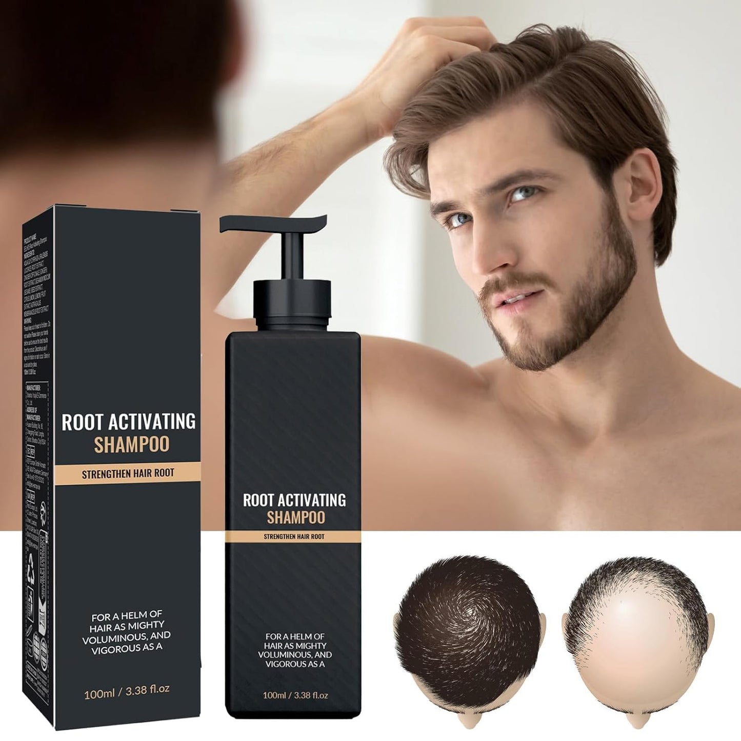 Root Activator Shampoo- Anti Hair Loss Treatment With Natural Regrowth Formula | Thickening & Nourishing For All Hair| Reduce Shedding,Smooths Hair,For Men & Women 2PCS