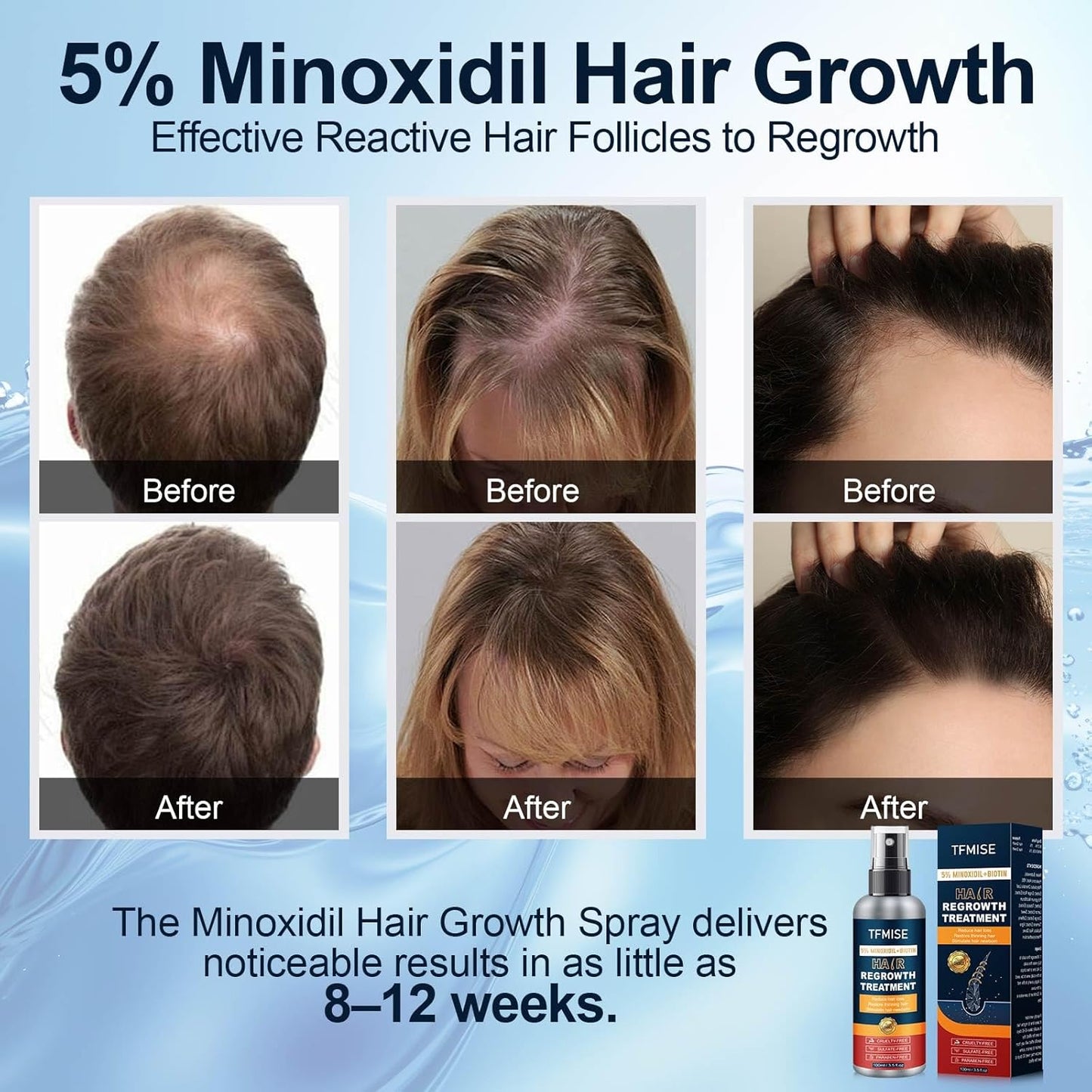 5% Minoxidil Spray for Men & Women - Extra Strength Hair Growth Solution with Biotin, 3.38 Fl. Oz