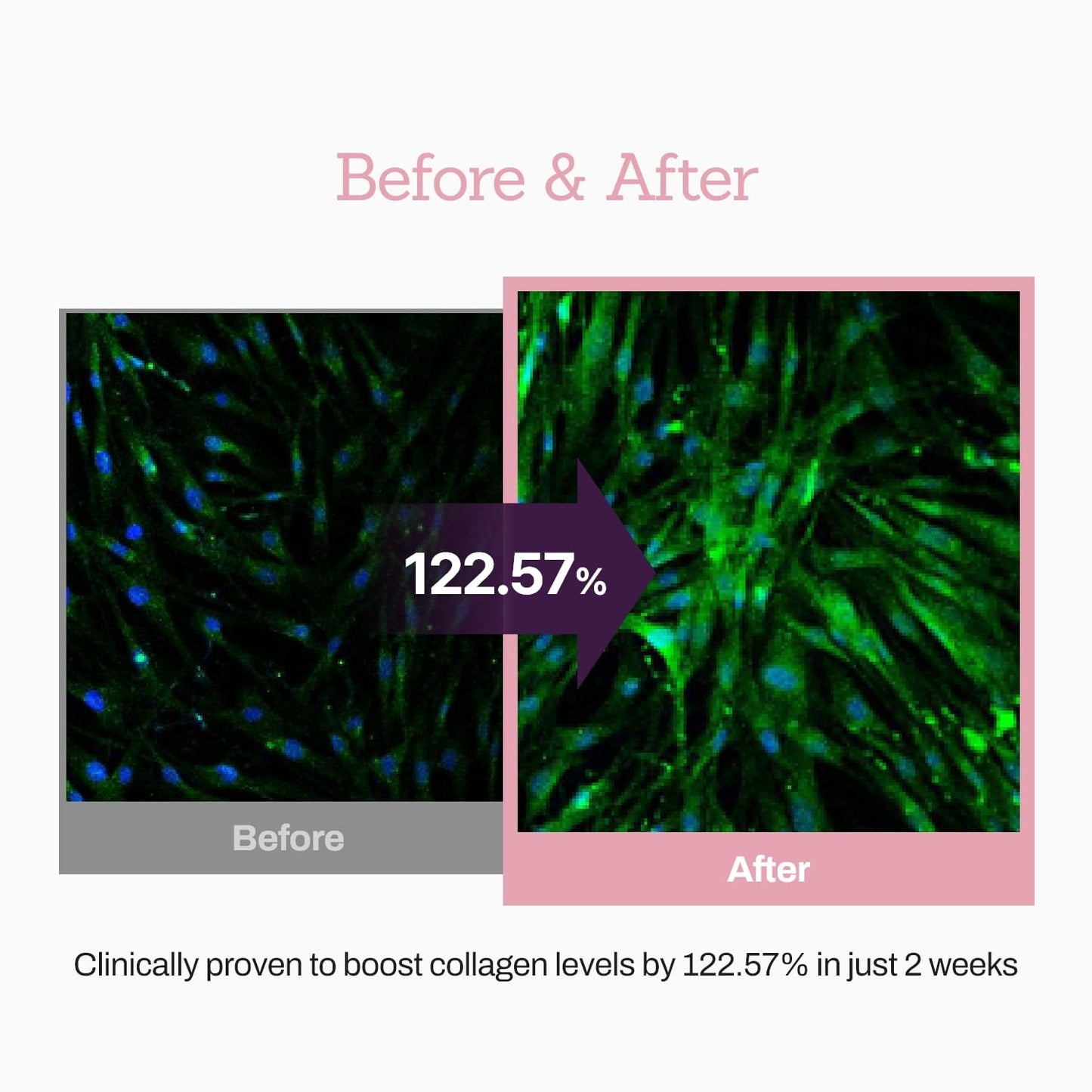 Collagen Peptide Serum for Firm, Youthful Skin - Reduces Deep Wrinkles & Boosts Elasticity, 1.01 fl. oz - Korean Skincare