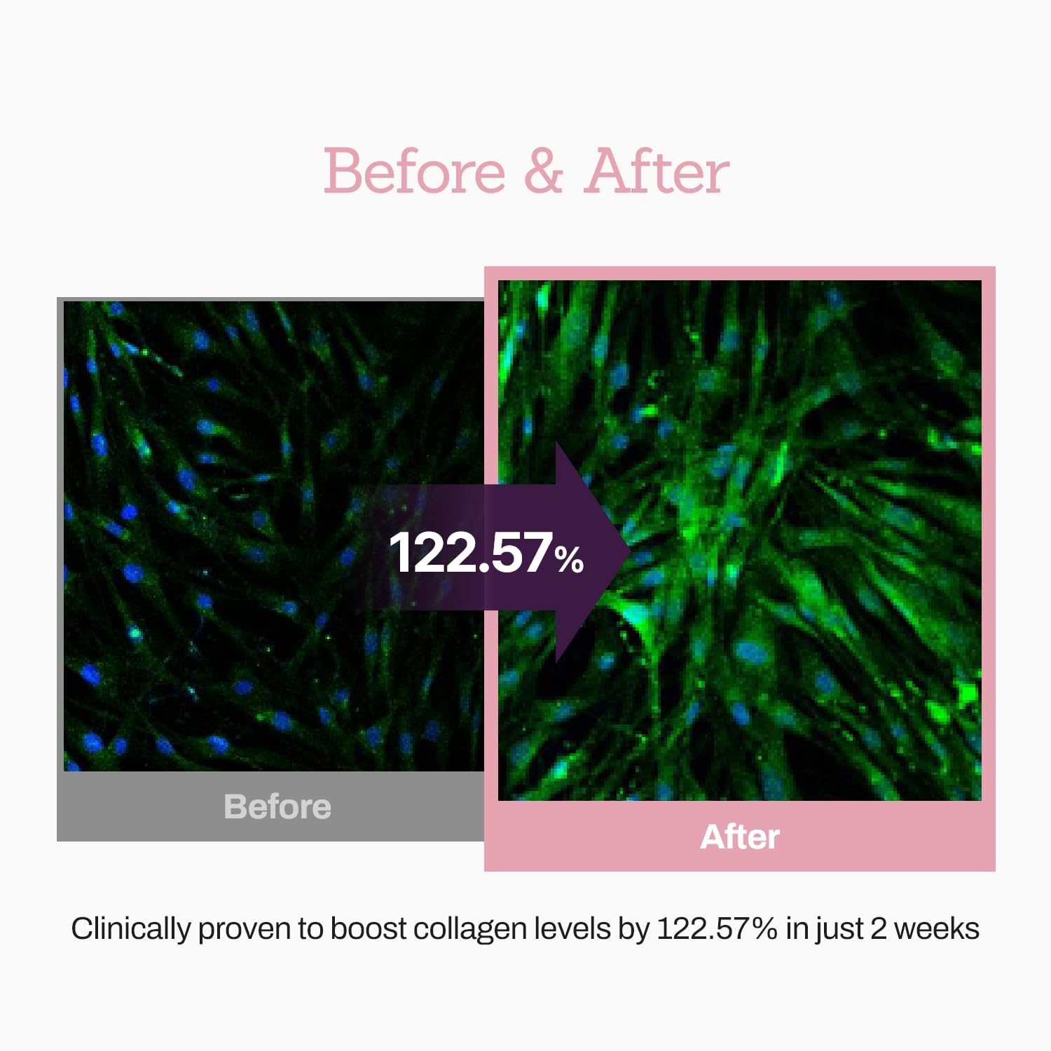 Collagen Peptide Serum for Firm, Youthful Skin - Reduces Deep Wrinkles & Boosts Elasticity, 1.01 fl. oz - Korean Skincare