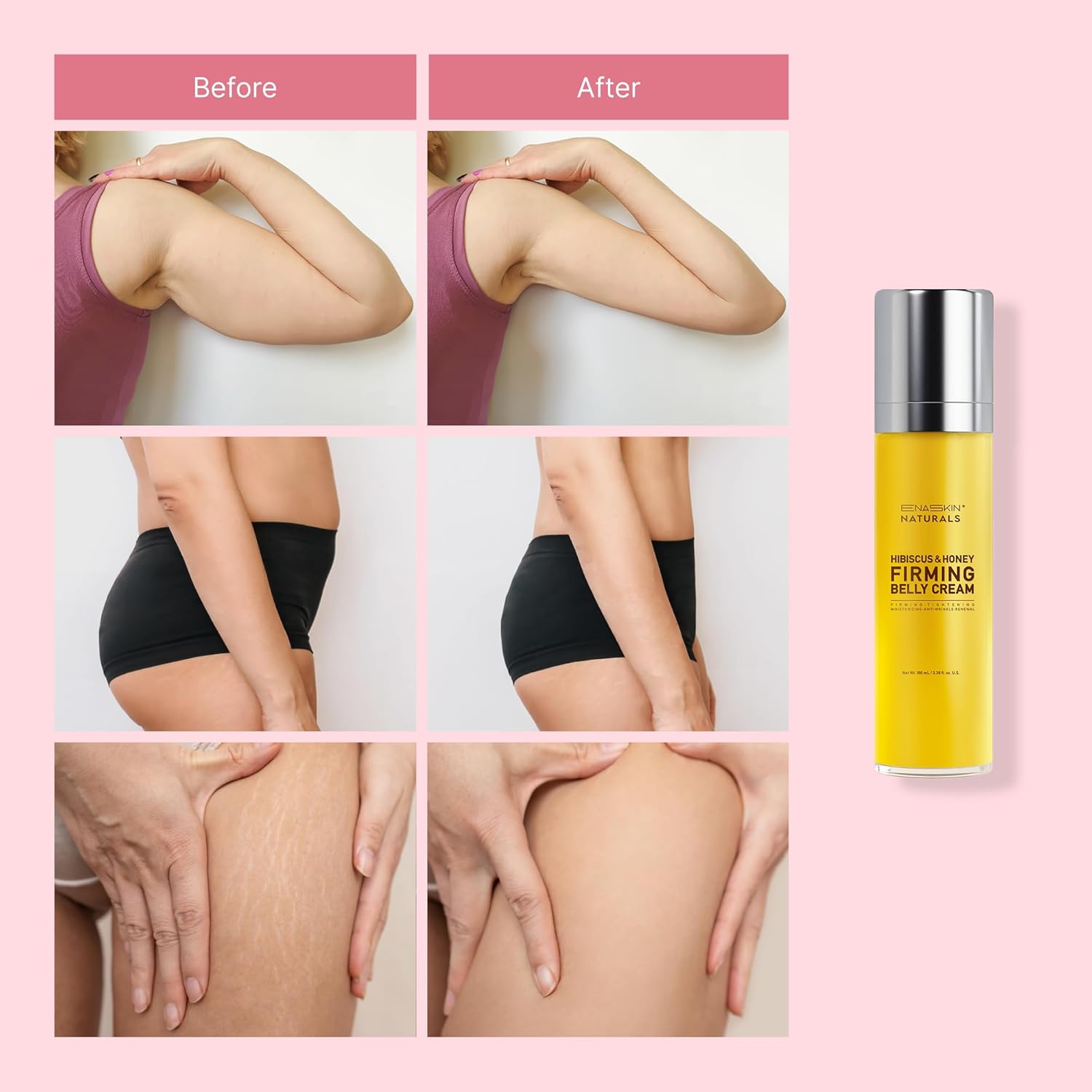Belly Firming & Skin Tightening Cream with Hibiscus & Honey - Moisturizing Cellulite Lotion for Stomach, Thighs & Butt - 100ML