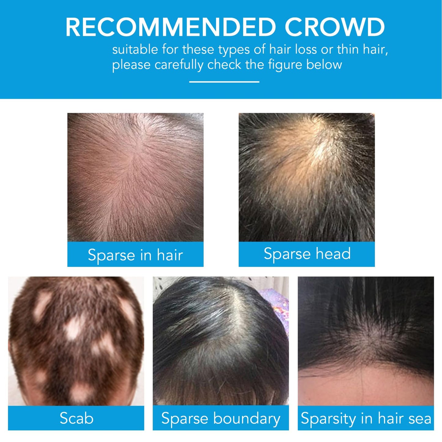 Hair Building Fibers, Hair Thickening Fibers for Thinning Hair & Bald Spots Thicker Fuller Hair in 15 Seconds Suitbable for Man and Woman 0.97Oz (Dark Brown)
