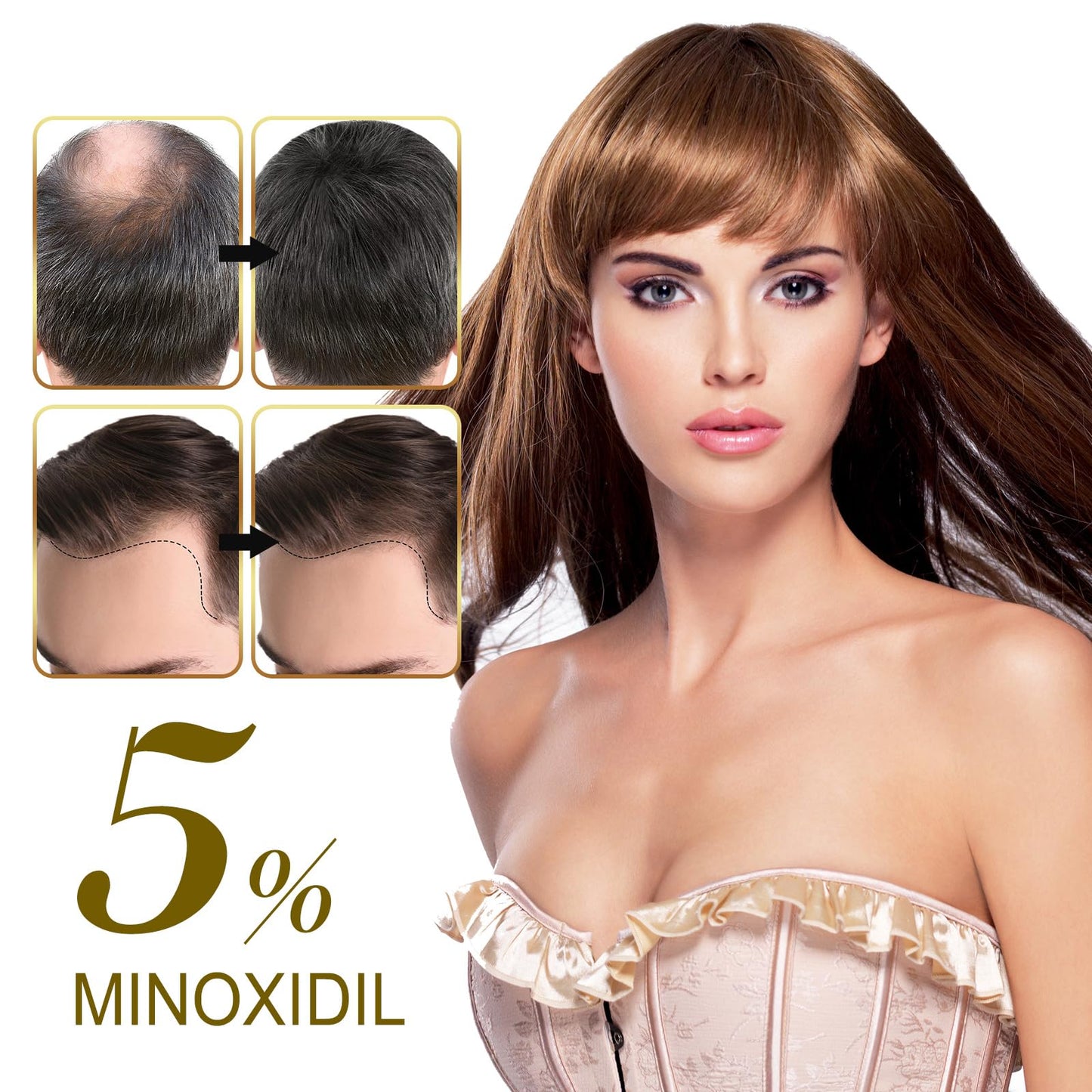 5% Minoxidil for Men and Women - Biotin Hair And Beard Growth Serum & 5% Minoxidil Treatment for Stronger Thicker Longer – Natural Growth Thickening Treatment - Stop Thinning & Hair Loss-1Month supply