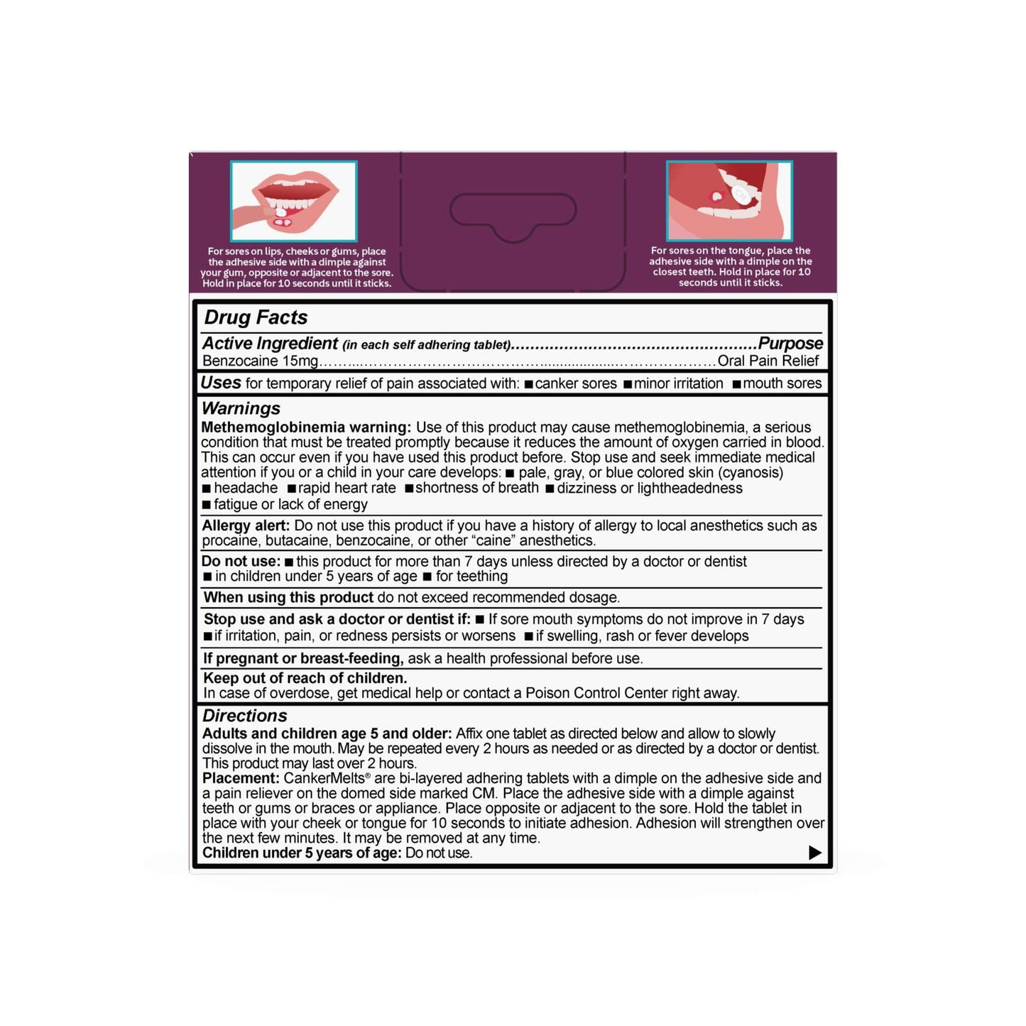Oracoat CankerMelts Canker Sore Treatment - Stick-On Pain Relief Melts for Fast Acting Relief Inside Mouth with Benzocaine, Hyaluronic Acid & Vitamin B12, Pack of 20