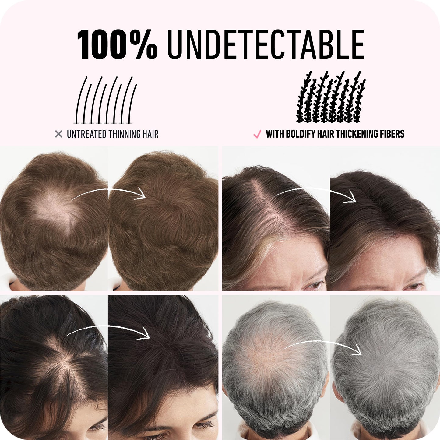 BOLDIFY Hair Fibers (28g) - Fill In Thinning and Fine Hair for an Instantly Fuller, Thicker Look - 14 Shades for Women & Men - Dark Brown