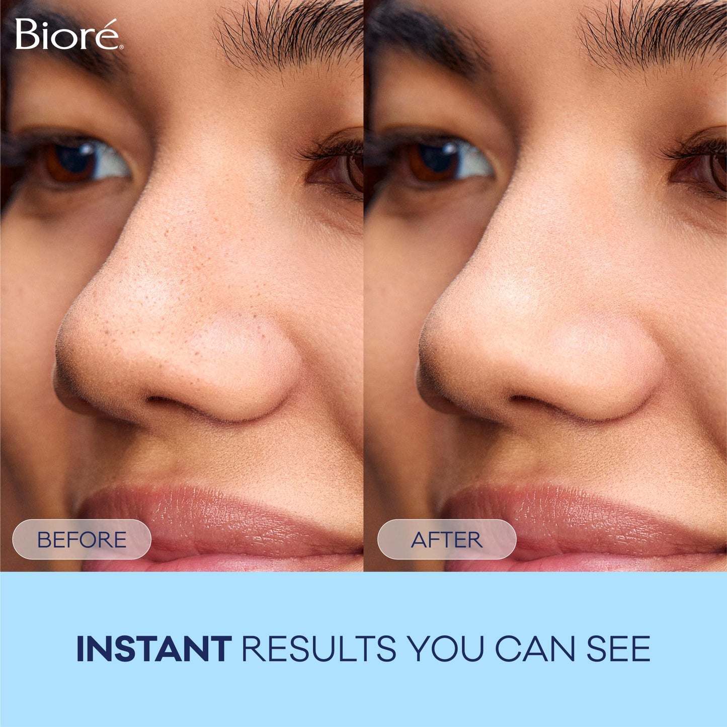 Bioré Original Blackhead Remover Strips, Deep Cleansing Nose Strips With Instant Pore Unclogging, Features C-Bond Technology, Oil-Free, Non-Comedogenic Use, 14 Count