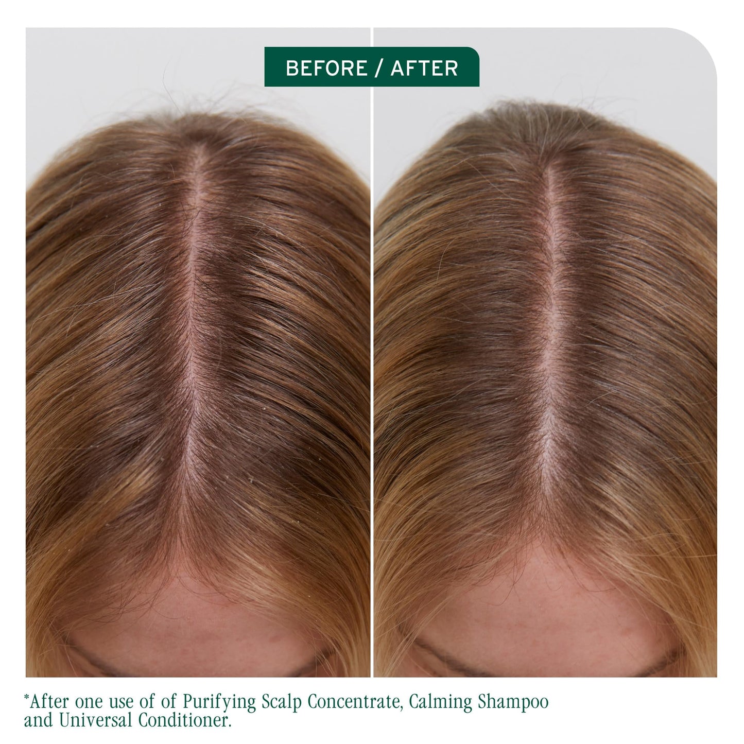 Biolage Scalp Sync Universal Conditioner - Nourishing & Hydrating for All Scalp Types, Lightweight Conditioning, Fermented Tea Blend & Glycolic Acid, Vegan & Paraben-Free, 8 Fl Oz, packaging may vary
