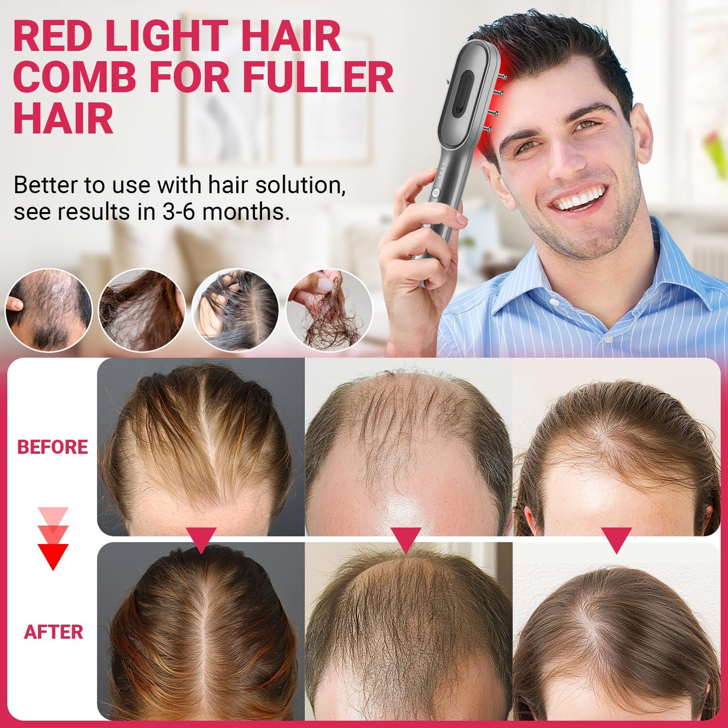 Hair Growth Comb - RRZIOM Red Light Comb for Women and Men