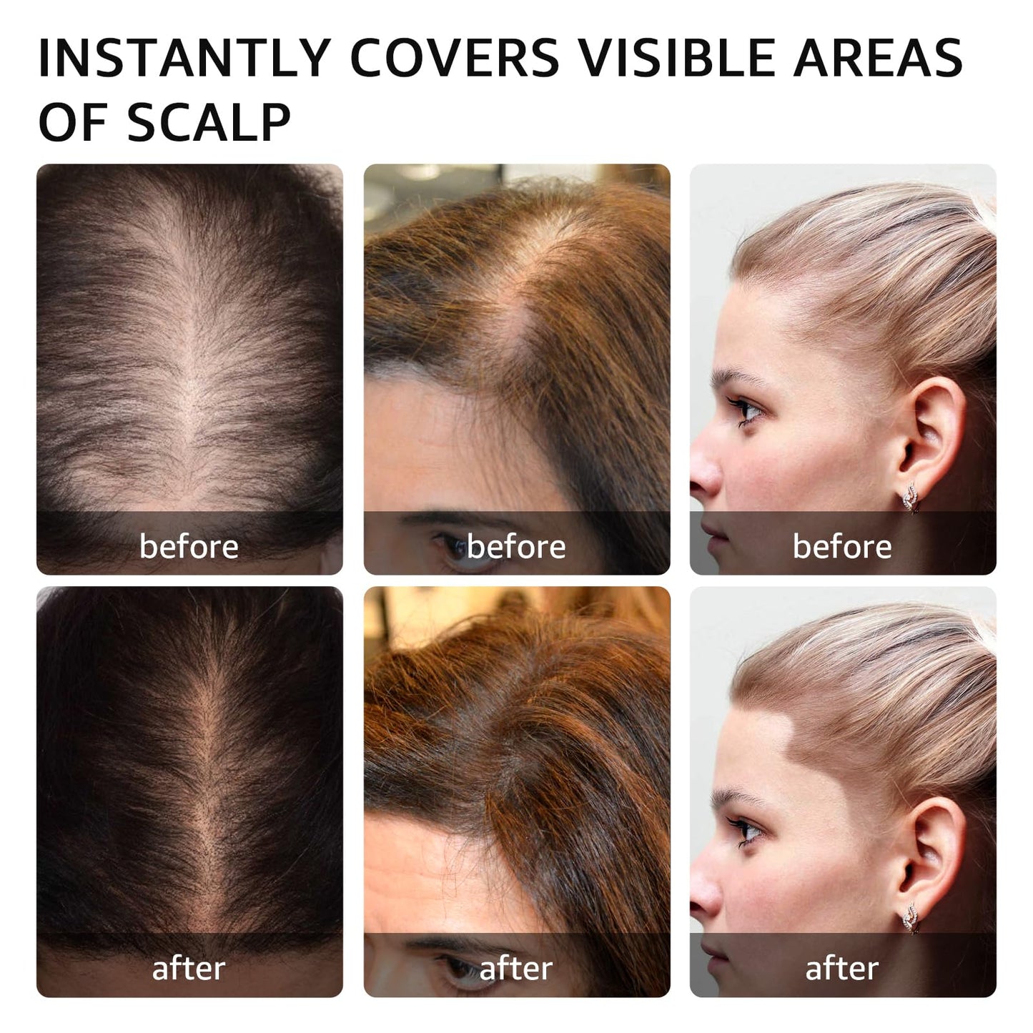 Instantly Hairline powder, Root touch up hair color for gray coverage, hair powder for women men bald spot loss and thin concealing(Dark Brown)