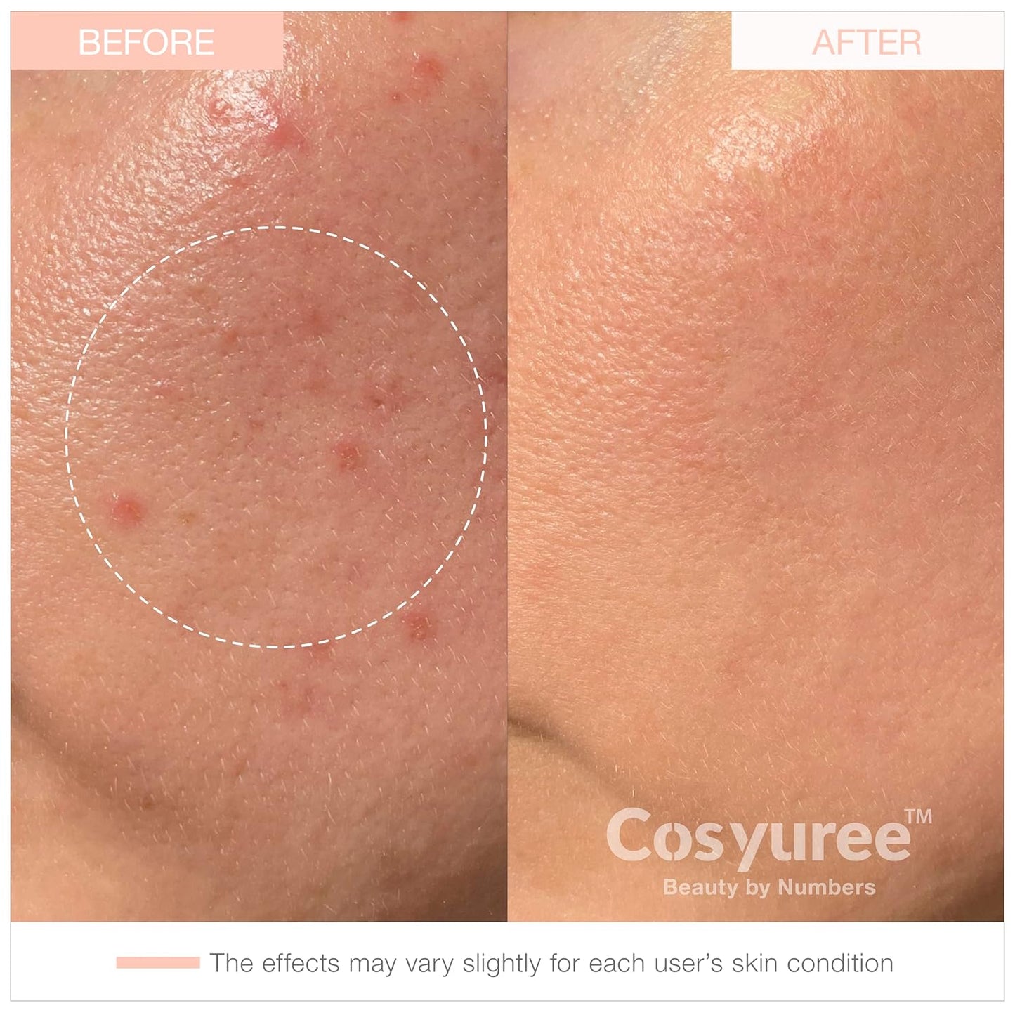 Hydrating Korean Collagen Hydrogel Mask - Deep Absorption Overnight Treatment for Glass Skin (34g x 5)
