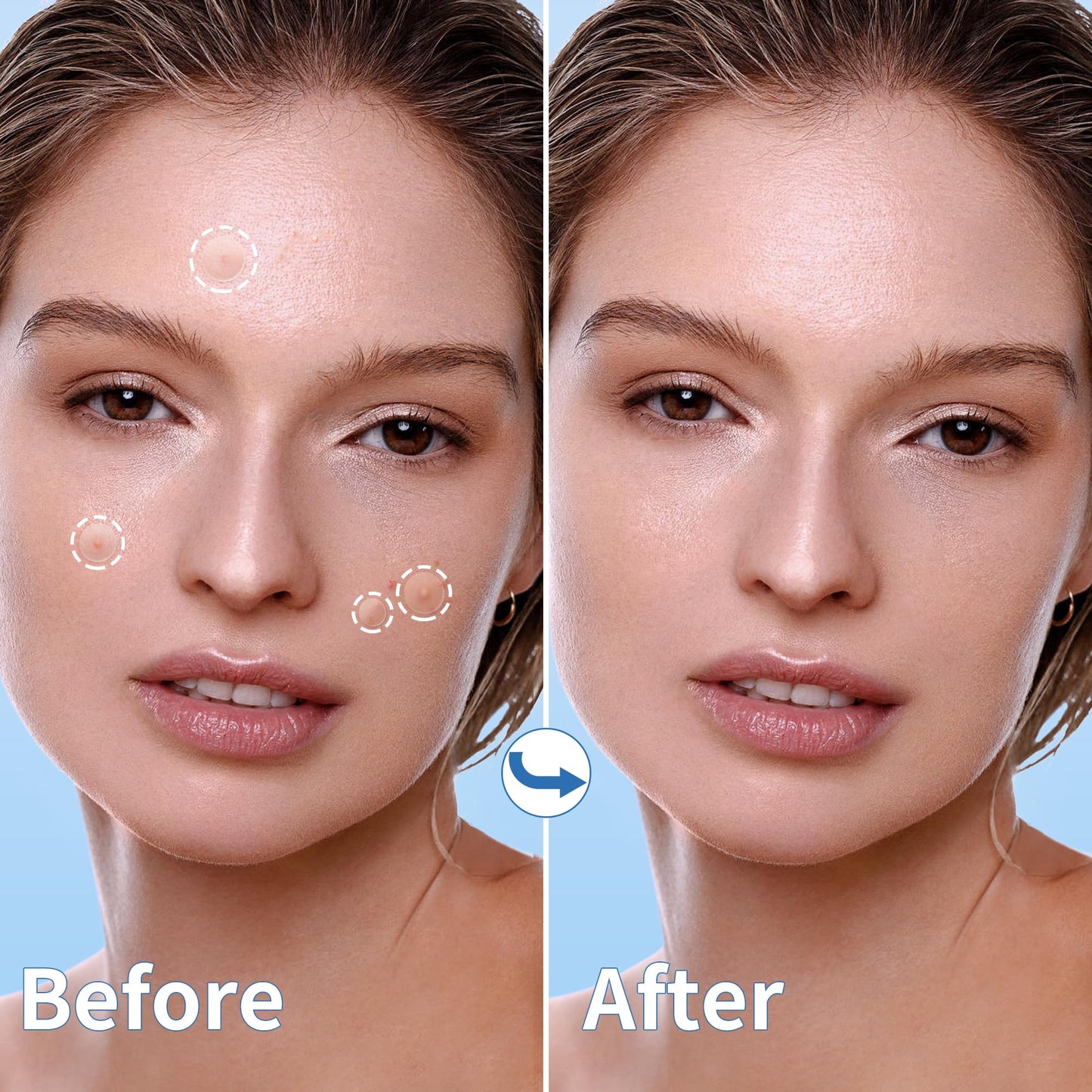 Daolyo Pimple Patches for Face, 4 Size 300 Counts Acne Patches, Hydrocolloid Patches for Covering Zits and Blemishes, Spot Stickers with Salicylic Acid, Tea Tree Oil & Calendula Oil