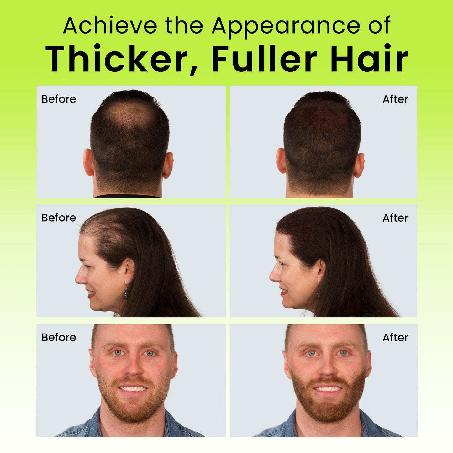 ECLIPSE Hair Fibers Dark Brown for Thinning Hair for Women & Men to Conceal Hair Loss in 15 Seconds - 100% Undetectable Hair Building Fibers, 30g