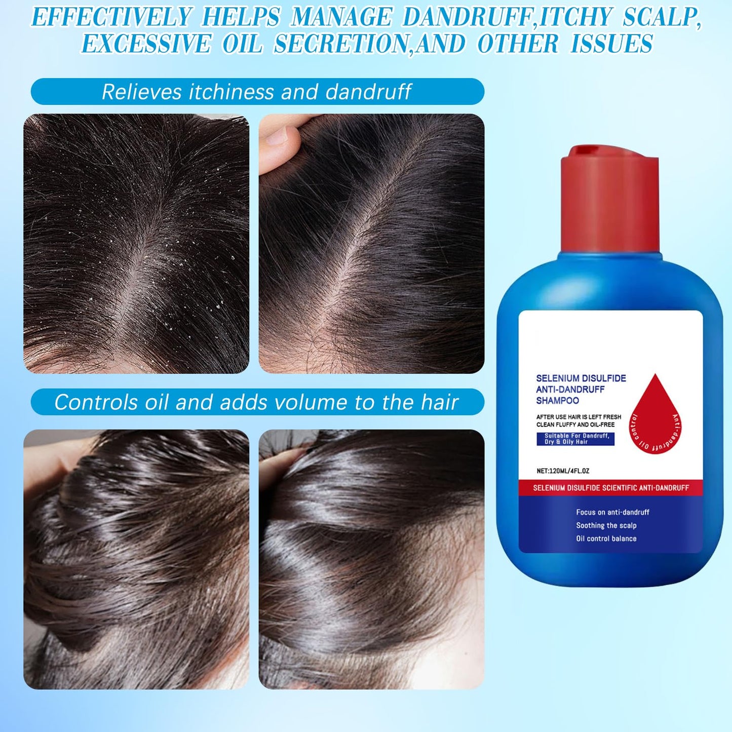 Nipori Shampoo,Nipori Oil Control Refreshing Anti-Dandruff Cleansing Shampoo,Anti Hair Loss for Men and Women
