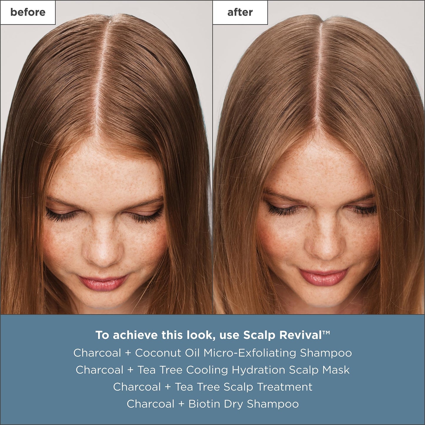 Briogeo Scalp Revival Charcoal + Tea Tree Scalp Treatment, Scalp Serum to Soothe a Dry, Flaky, Itchy Scalp, Absorb Oil, Hydrate Dry Scalp, Clarify Build Up, Vegan, Cruelty-Free, 1 fl oz