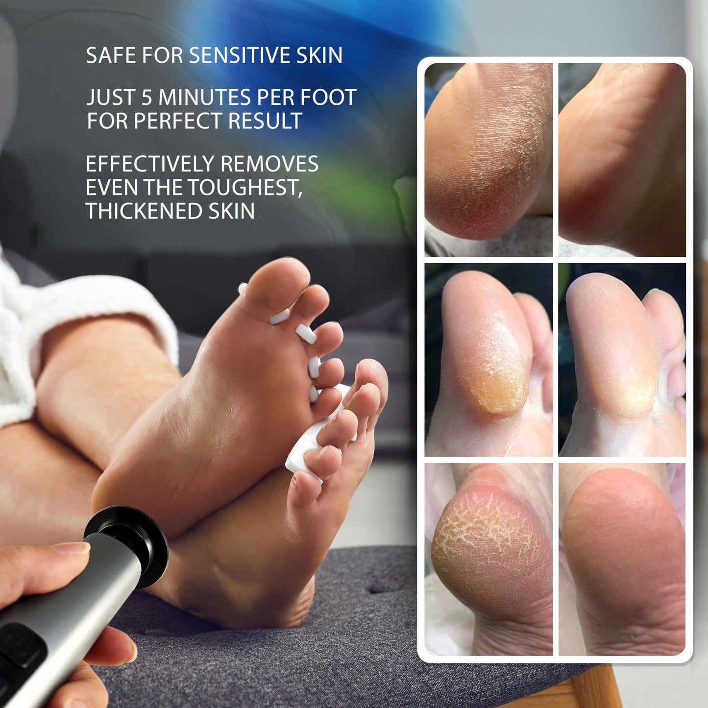 Spargos Electric Foot Callus Remover Rechargeable - Black Electric Foot Filer with 9 Speed Settings, Type-C Charging, and 60 Sanding Discs for Smooth Skin - Callus Remover for Feet