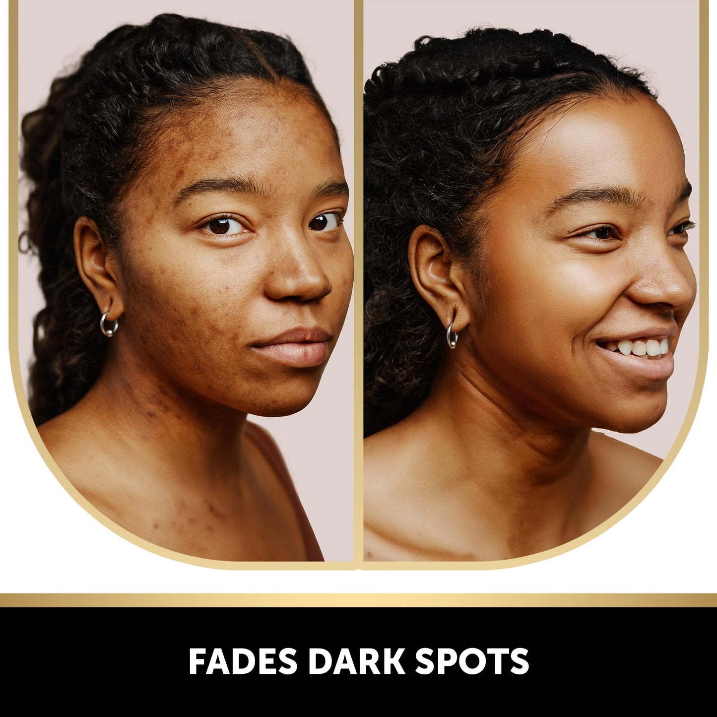 VALITIC Kojic Acid Soap for Hyperpigmentation - with Glutathione, Collagen & Vitamin C - Natural Soap Bars with Turmeric - Original Japanese Complex for Dark Spot Correction - 4 Pack