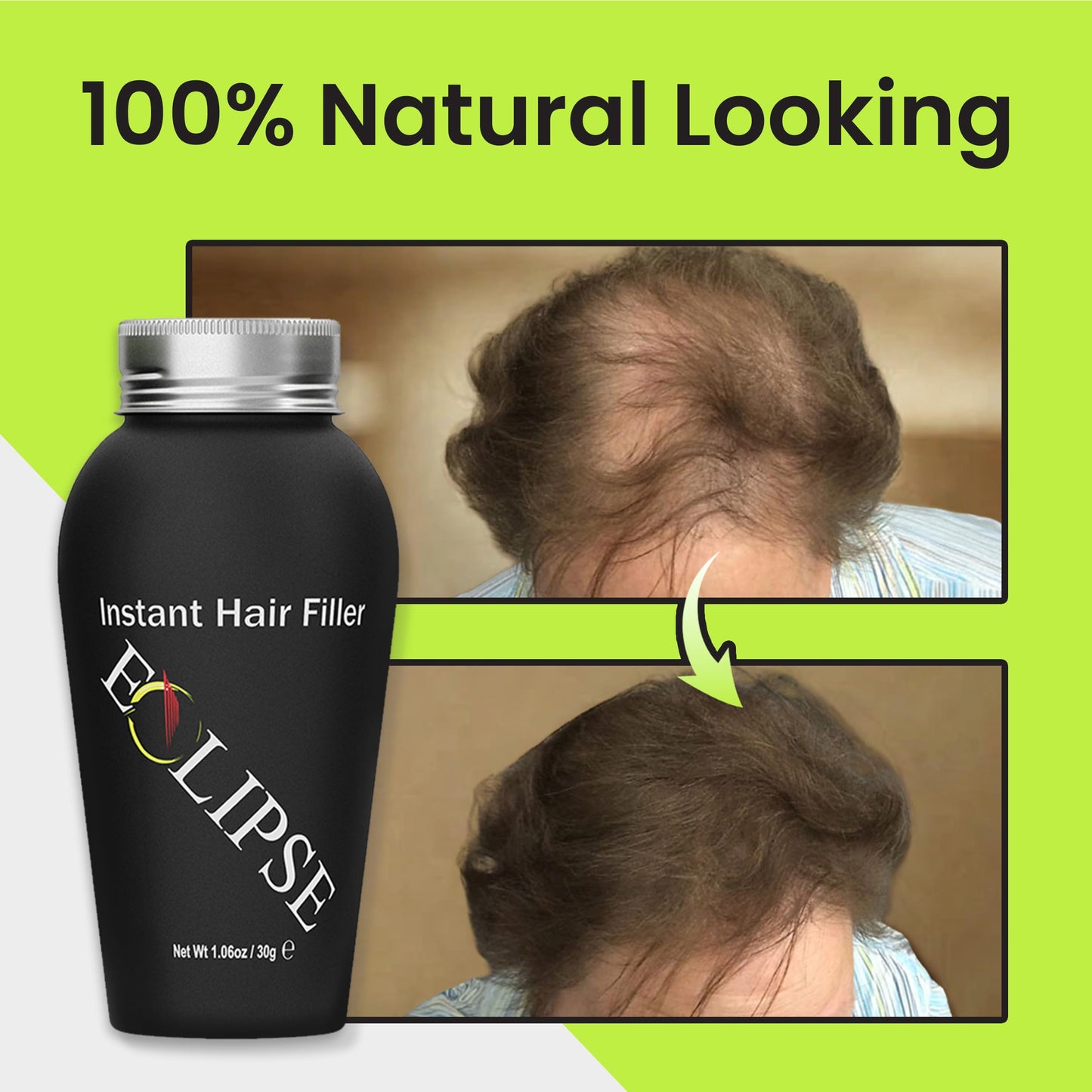 ECLIPSE Hair Fibers Dark Brown for Thinning Hair for Women & Men to Conceal Hair Loss in 15 Seconds - 100% Undetectable Hair Building Fibers, 30g
