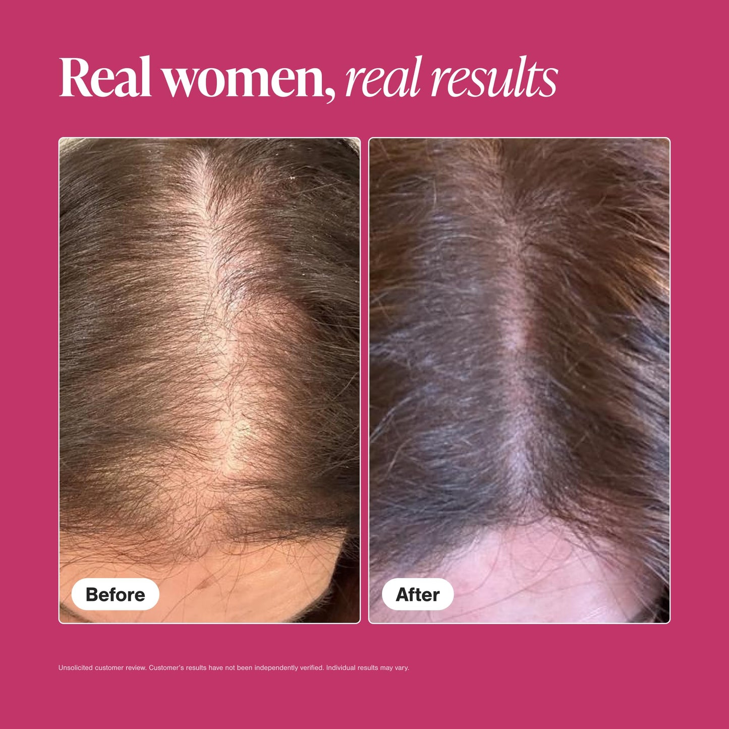 Viviscal Hair Growth Supplements For Women For Thicker, Fuller Hair, Nourishes Thinning & Loss, With Proprietary Collagen Complex, 180 Tablets, 3 Month Supply
