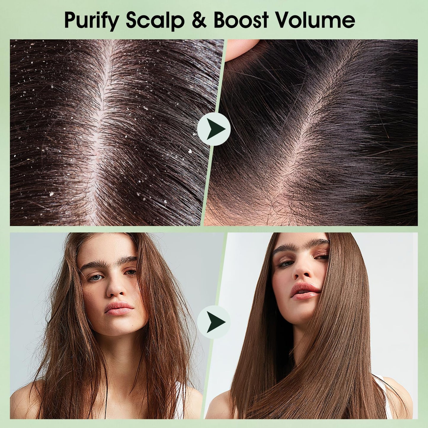 VOERUY Scalp Scrub, Tea Tree Scalp Exfoliator Scrub Shampoo, 2-in-1 Scalp Treatment with Mint Oil, Hair Treatment to Clarify and Remove Build up with Silicone Scalp Massager, 10.6oz/300g