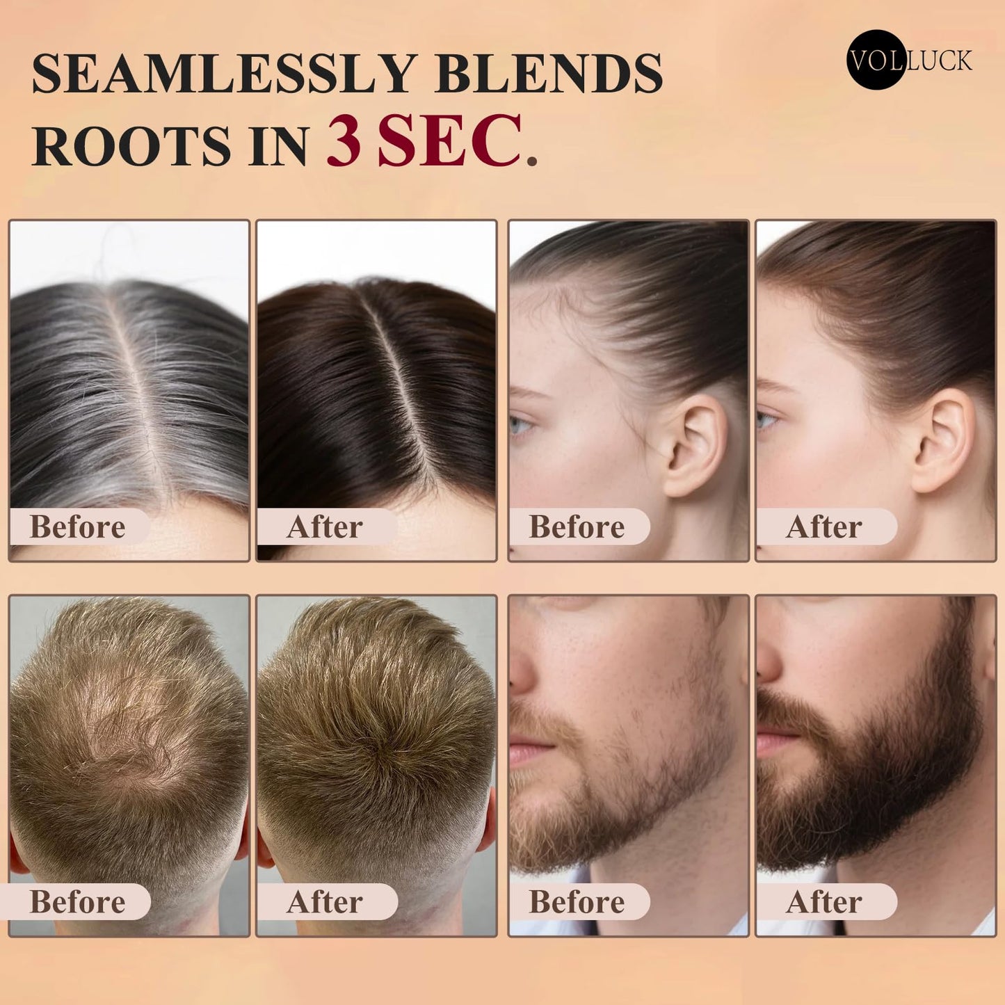 VOLLUCK Hairline Powder Instantly, Root Touch up Powder Hair Color Upgraded, Grey Root Cover up Conceals Hair Loss, Hairline Shadow for Women & Men for Thinning Hair Natural, Sweatproof (Medium Brown)