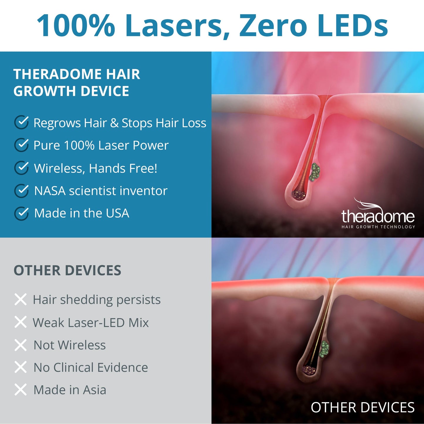 Theradome PRO Laser Hair Growth Helmet LH80 – 100% Laser, No Ineffective LEDs – FDA-Cleared Red Light Therapy for Hair Regrowth 2x Week – Made in the USA