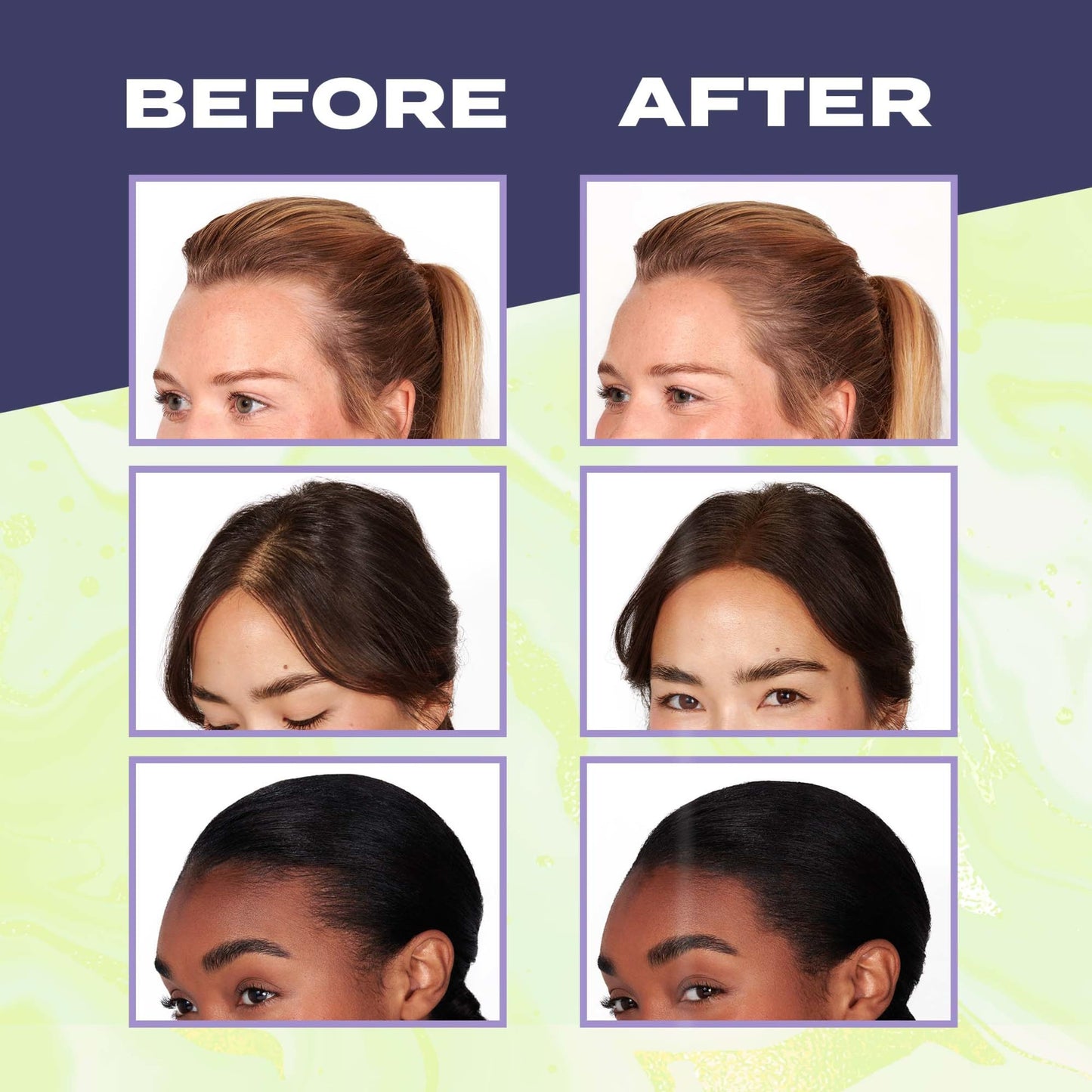 Toppik Fill Me In Hairline Filler, Hair Color Root Touchup, Hair Fibers Wand, Fills In Thinning Hairline, Hair Styling Product, 0.176 oz (5 g), Dark Brown